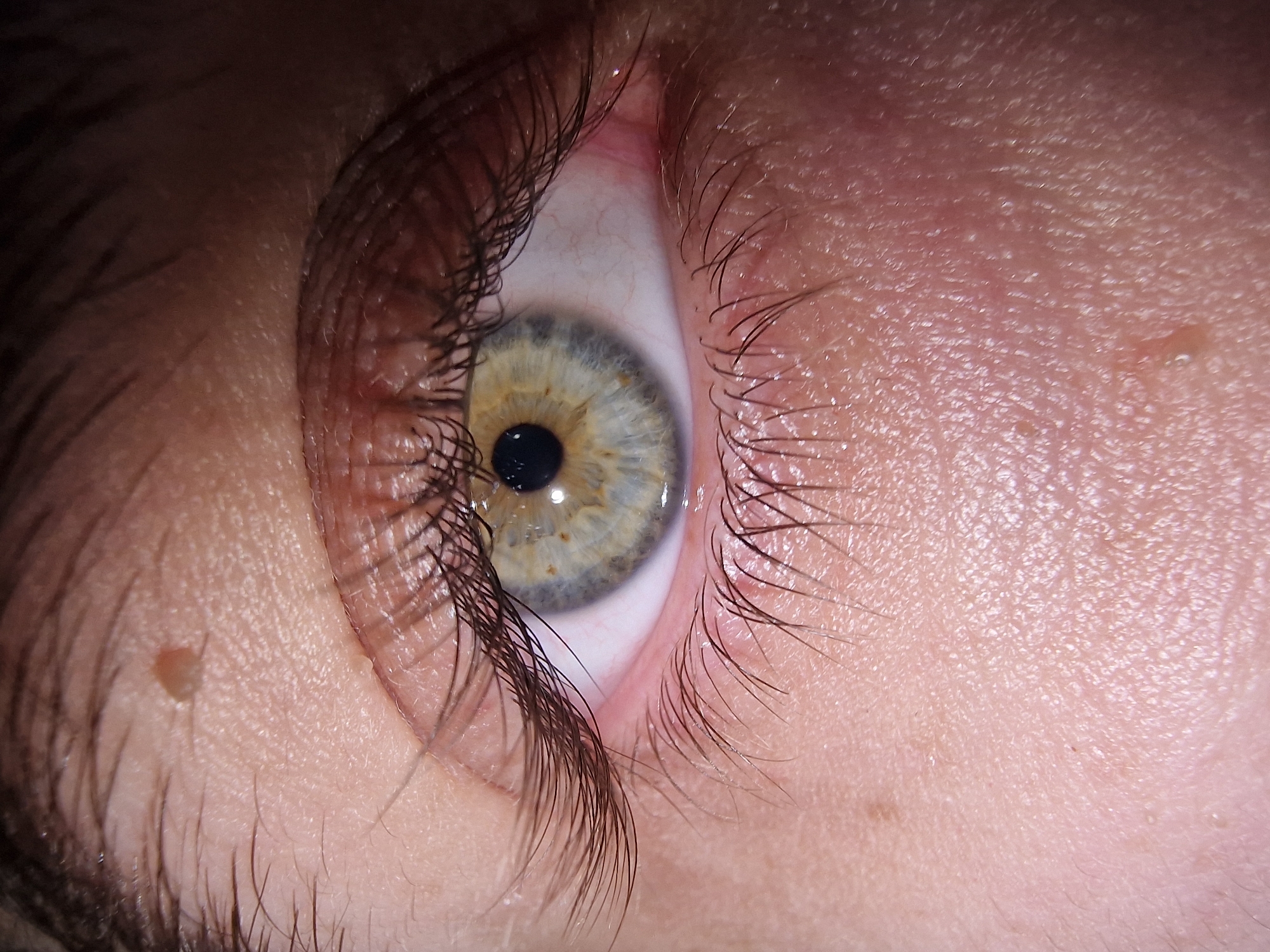 A close-up image shows a human eye with multicolored iris. The iris contains blue, yellow and green shades with a dark pupil. There are eyelashes surrounding the eye. The skin surrounding the eye appears light-colored with some skin textures visible. There are also some small marks or moles on the skin above the eye. The location in the city is unknown, unknown.