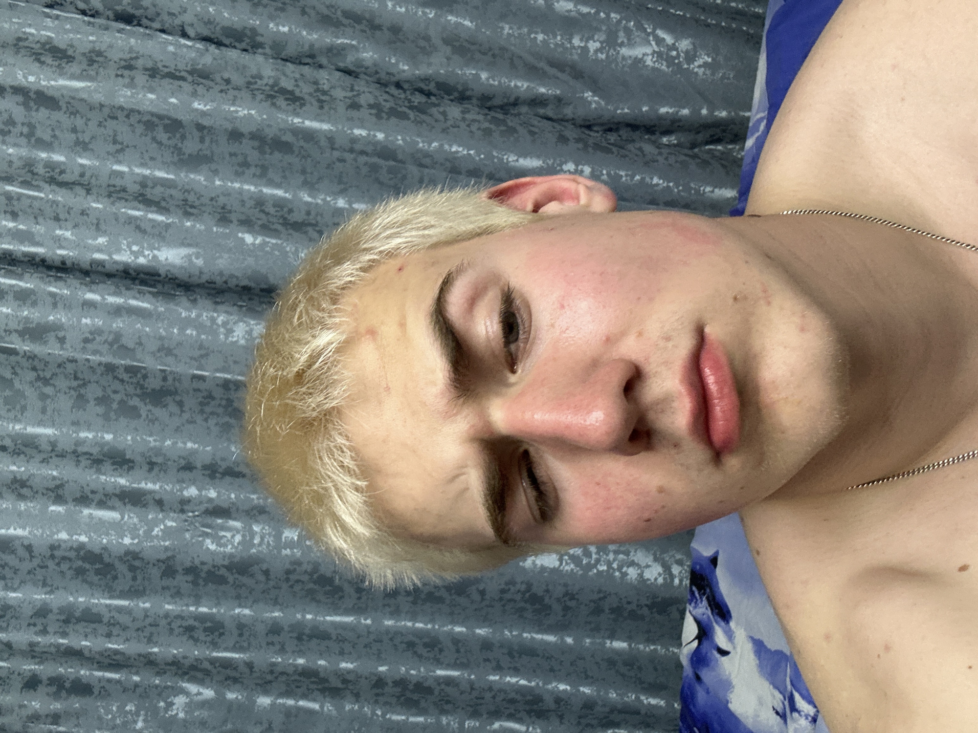 The image displays a person with short, light blonde hair and fair skin, lying down indoors. The person's head is tilted to the side, giving a rotated perspective of their face. Their eyes are partially closed or directed downwards, and their lips are slightly parted, conveying a neutral or contemplative expression.
The person has visible redness and several small blemishes or acne spots on their forehead, cheeks, and chin. A faint stubble can be seen around the jawline. A thin silver chain necklace is worn around their neck, draped across their shoulder and collarbone, suggesting they may be shirtless or wearing minimal clothing.
The background primarily features a textured grey fabric, likely a sheet or blanket, with horizontal patterns of lighter grey and white streaks. To the right of the person's body, a piece of blue fabric with a lighter abstract or patterned design is visible, possibly part of another sheet or garment. The lighting in the image suggests an indoor setting, likely a bedroom. No text is visible in the image.