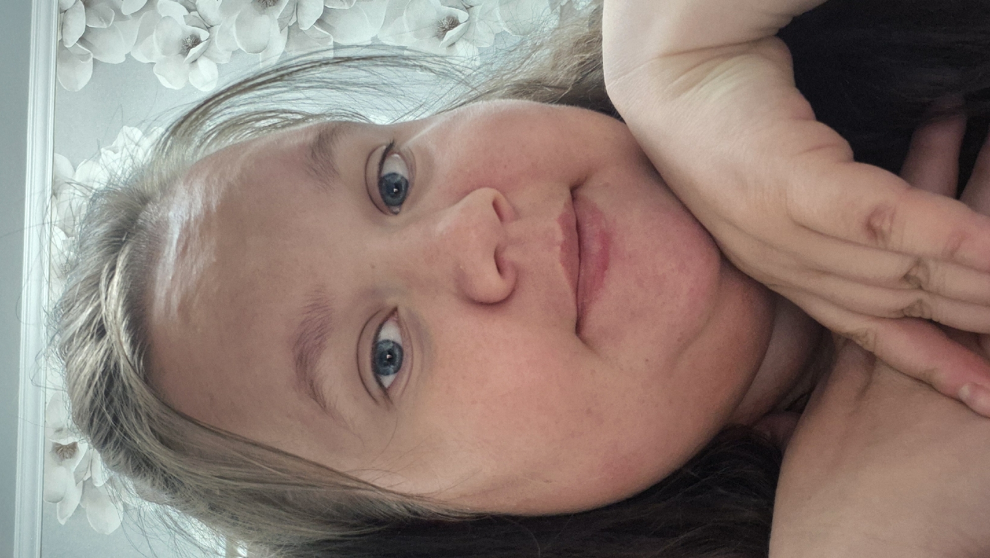 An individual is depicted in a close-up, eye-level portrait, stated to be taken in the city of Chaikovsky, Russia. The person has light brown hair, blue eyes, and fair skin exhibiting some redness on the cheeks and chin. Their gaze is directed forward. The individual's right hand (viewer's left) supports their chin and jawline. The mouth is closed with a slight upward curve. The background is a light blue-grey wall adorned with a textured wallpaper featuring multiple white, three-dimensional floral patterns.