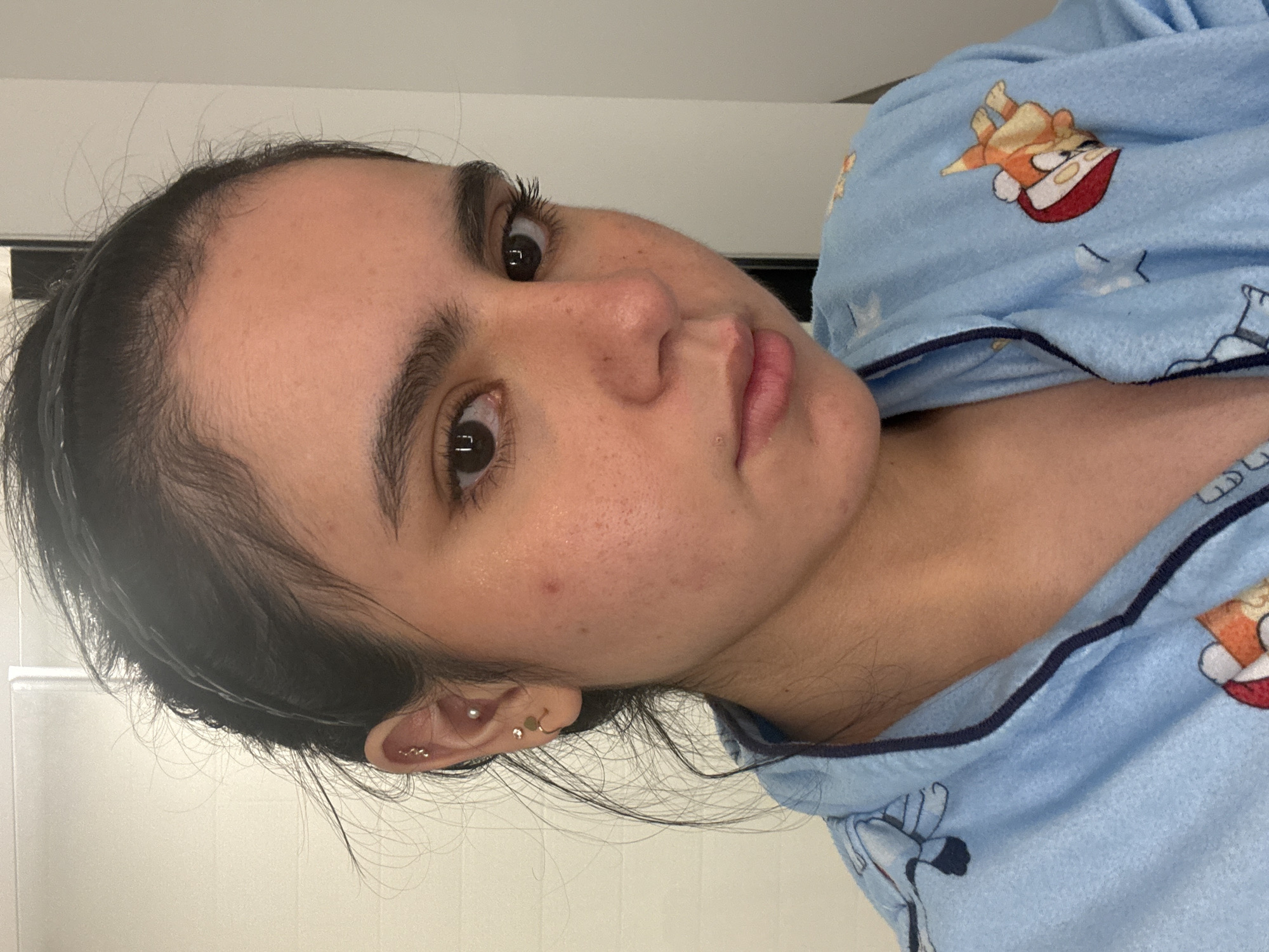 The image is a close-up, vertically oriented portrait of a young person, likely a woman, from the chest up. She has dark hair pulled back, revealing her forehead and temples, with some wisps of hair framing her face. Her skin appears to have some texture and a few small blemishes on her cheeks. She has dark, expressive eyes, thick eyebrows, and a neutral to slightly curious facial expression. Her lips are lightly colored. She is wearing light blue pajamas with a cartoon print, featuring what appear to be characters in red and white hats. The background is a plain, light-colored wall. The lighting suggests an indoor setting, possibly during the day, given the brightness. There are no visible text elements in the image. The scene appears to be casual and personal, suggesting the photo was taken in a home environment.