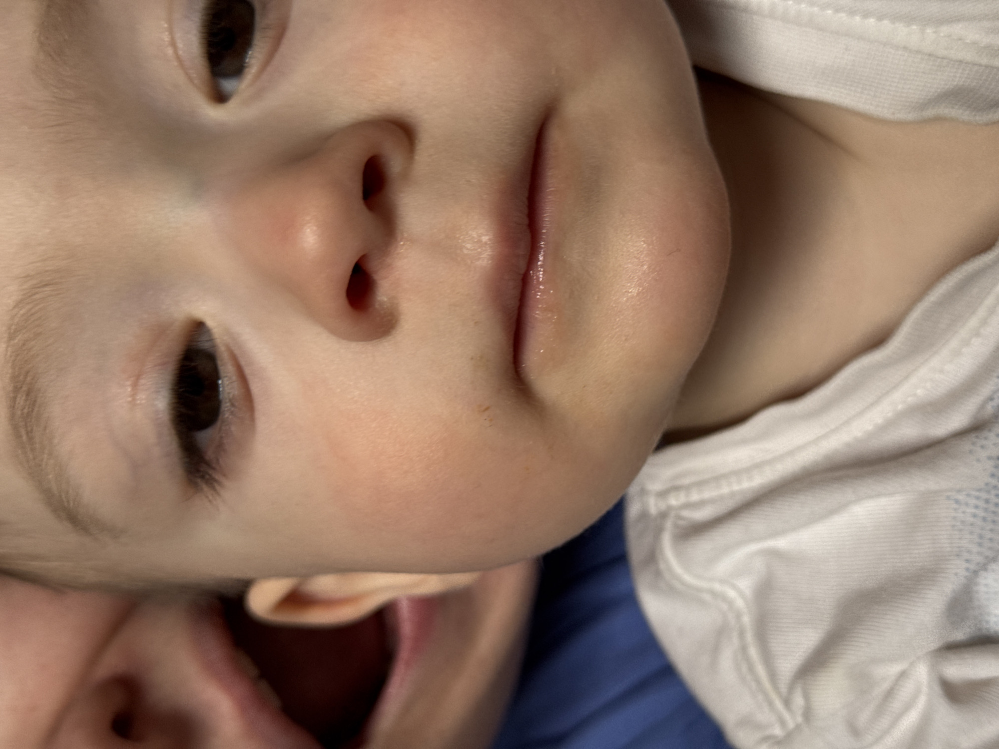 A close-up, slightly rotated image shows a baby's face. The baby has light skin, brown eyes, and is wearing a white shirt. Part of an adult face is visible in the lower left corner of the image. The background appears to be blue.
The location is not identifiable in the image.
