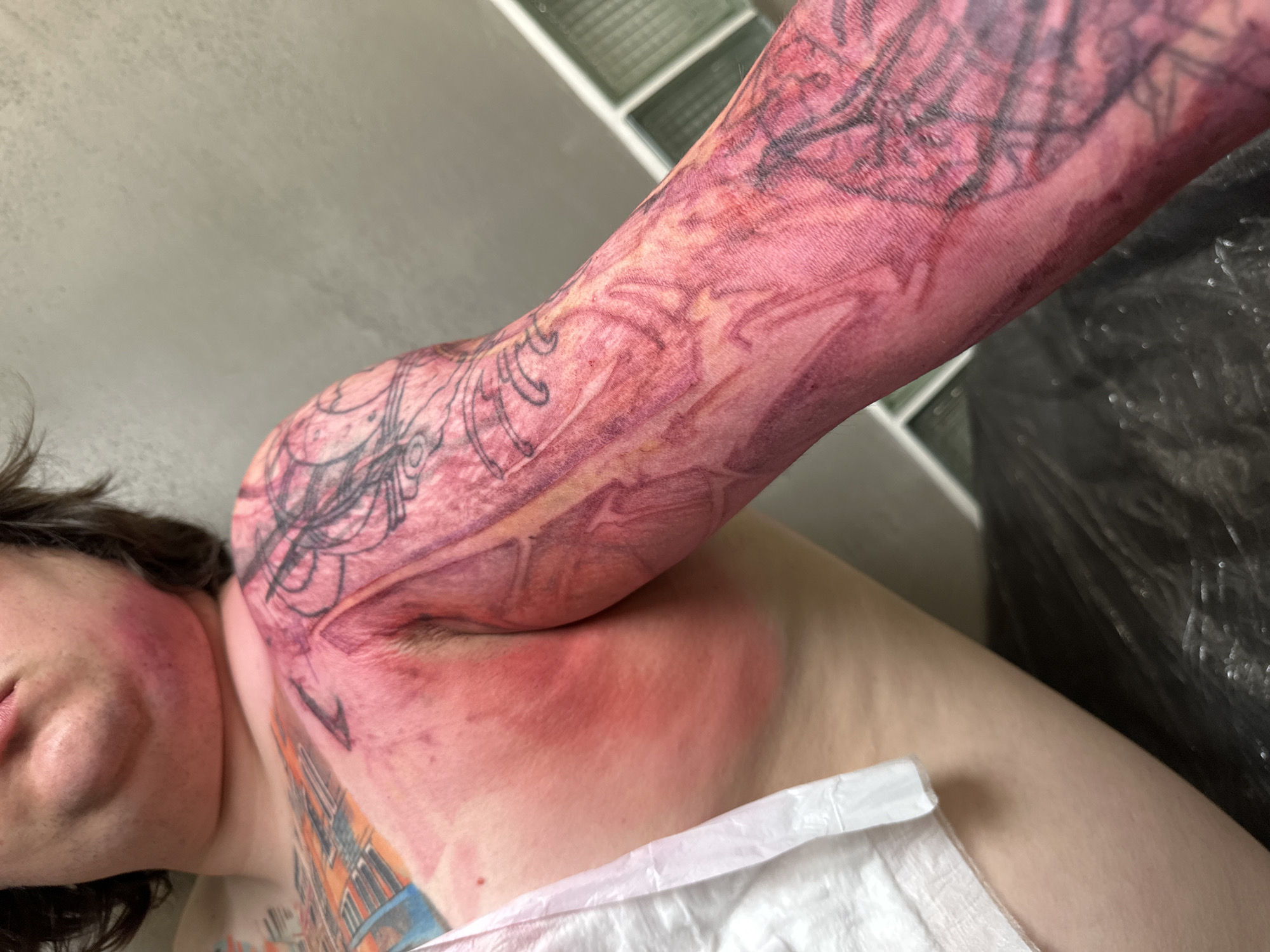 A close-up shot depicts a person lying down with their left arm raised and bent at the elbow. The arm, shoulder, and chest area are red and appear irritated or inflamed, possibly from a recent tattoo procedure. A tattoo is visible on the arm, featuring black lines and shading. The person's face is partially visible, showing redness and a closed eye. A white absorbent pad rests on the chest. In the background, a wall with frosted or textured glass blocks can be seen, along with a dark, possibly plastic, sheet or bag. The location is not discernable as Moscow, Russia based on the visual elements in the photograph.