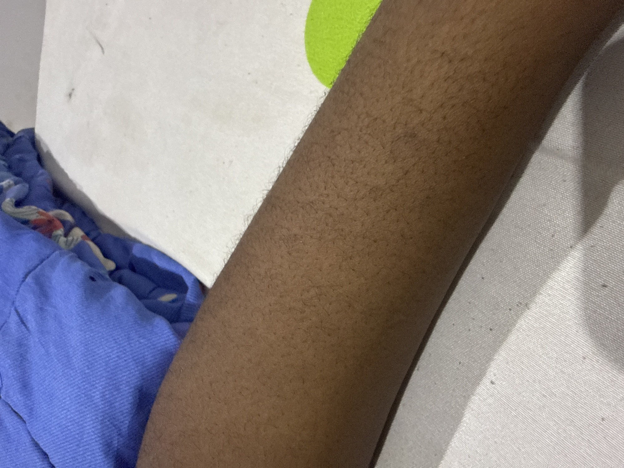The image presents a close-up view of a person's dark-toned arm, resting in what appears to be an indoor setting. The arm, covered in fine, dark body hair, extends diagonally across the frame. To the lower left, a portion of a blue garment, possibly shorts or pants, is visible, featuring a clear ribbed or woven texture and a small hole or tear near the top. Adjacent to the arm, both in the upper left and right sections of the image, is a white fabric, likely a bedsheet or pillowcase. This white material displays a subtle woven pattern with fine lines and scattered tiny dark specks. A vibrant lime green object, possibly a pillow or blanket, is partially visible behind the arm in the upper central area, adding a strong color accent. The scene suggests the person is reclining or resting on a soft surface like a bed. No specific activity is depicted, and no text is visible. The image itself does not provide explicit geographical or temporal cues, but it is contextualized as being from Abuja, Nigeria.