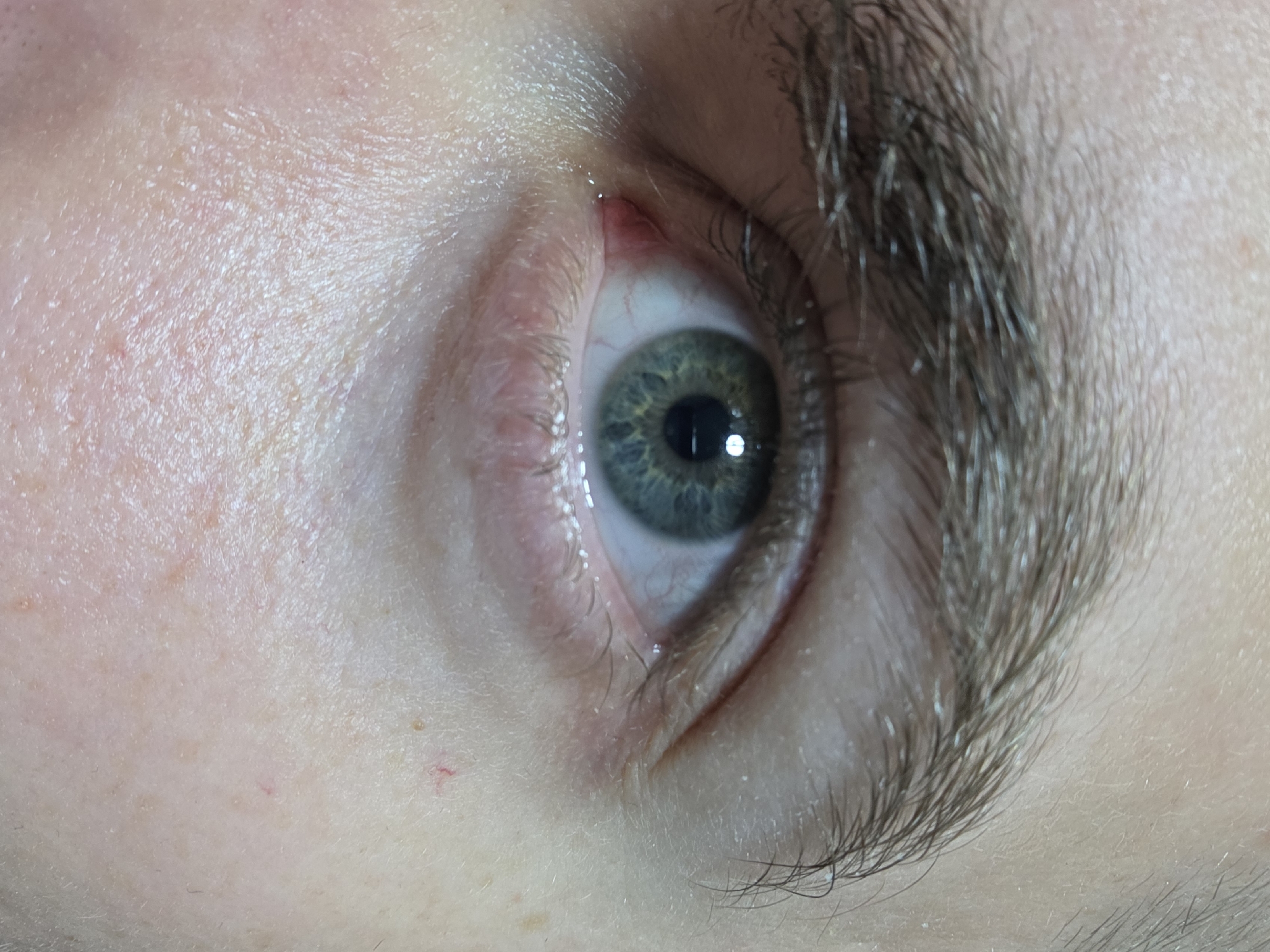 A close-up image shows a person's right eye and surrounding facial features. The eye has a light bluish-green iris with a visible pupil and a reflection indicating a light source. The skin around the eye is fair with visible veins and some small blemishes. The eyebrow is dark brown and somewhat bushy. The image does not provide any information to suggest a location in Yagodovo, Bulgaria.