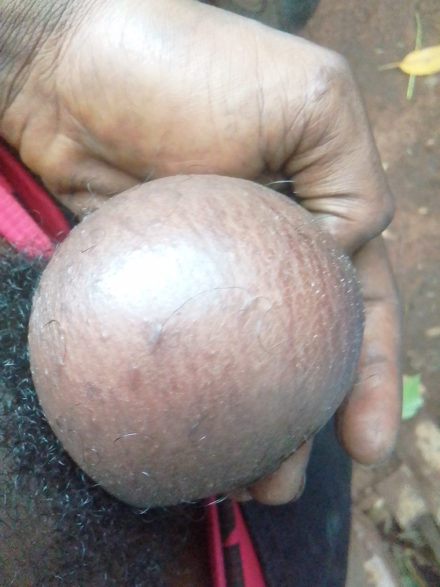 This image, taken in Owerri, Nigeria, presents a close-up view of a human scrotum, which appears distended and rounded, indicative of a potential hydrocele or similar enlargement. The skin of the scrotum is taut, shiny, and light brown with visible hair follicles and scattered, fine hairs. Coarse, dark pubic hair is visible at the bottom left of the frame. A human hand, with darker skin tone and visible wrinkles, partially supports or grasps the upper right portion of the scrotum. The background is out of focus, revealing a natural outdoor setting with brown earth and indistinct green and yellow foliage.