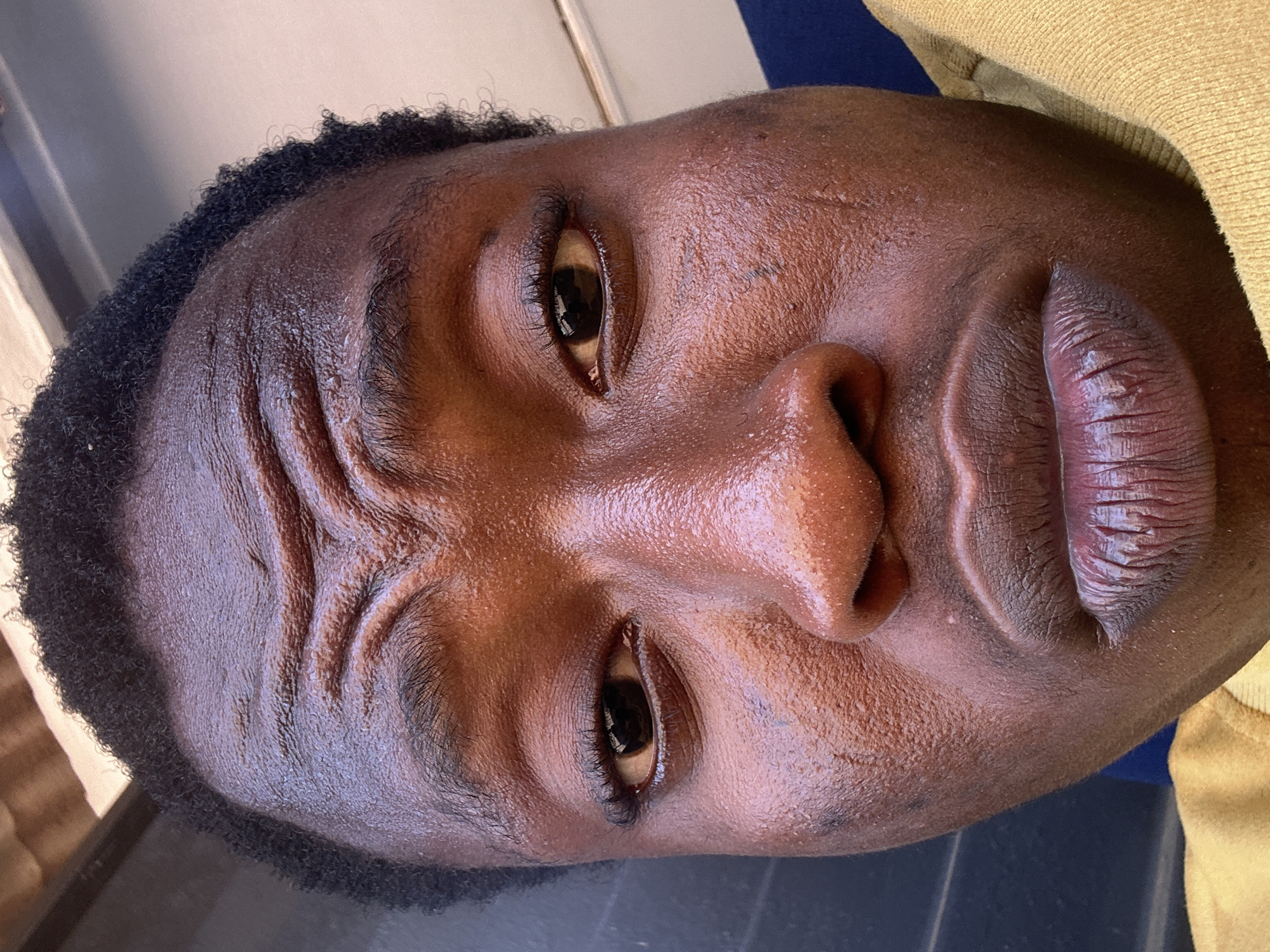 A close-up portrait of a Black person is presented. The face is oriented so that the top of the head is to the left side of the frame, and the chin is to the right. The subject has short, dark hair. Distinct tribal markings are visible on the forehead. The eyes are open, and the lips are slightly parted. The skin appears to be moist or oiled. The location is Unknown, Unknown.