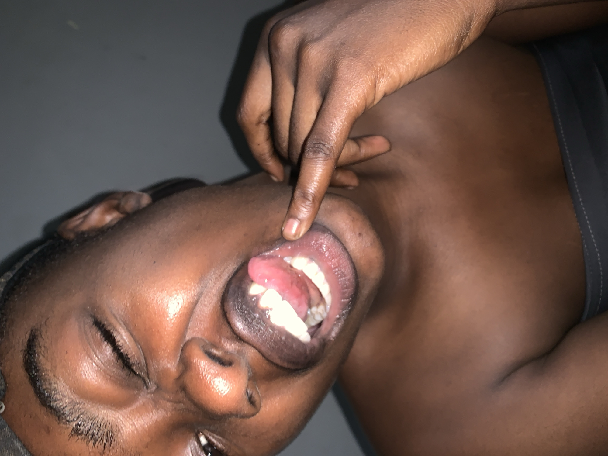 This media file is a close-up, vertically oriented photograph of a person's face and upper body. The subject appears to be of African descent and is lying down, with their head tilted. Their eyes are closed, and one hand is raised, with a finger pointing into their open mouth, revealing their teeth and tongue. The lighting is dim, suggesting an indoor setting, and the background is a plain, dark surface, possibly a wall or floor. There are no visible text elements in the image. The overall mood is introspective and somewhat disheveled. The location context of Rafin Par, Nigeria, implies a potential setting, but there are no specific visual cues to confirm this.