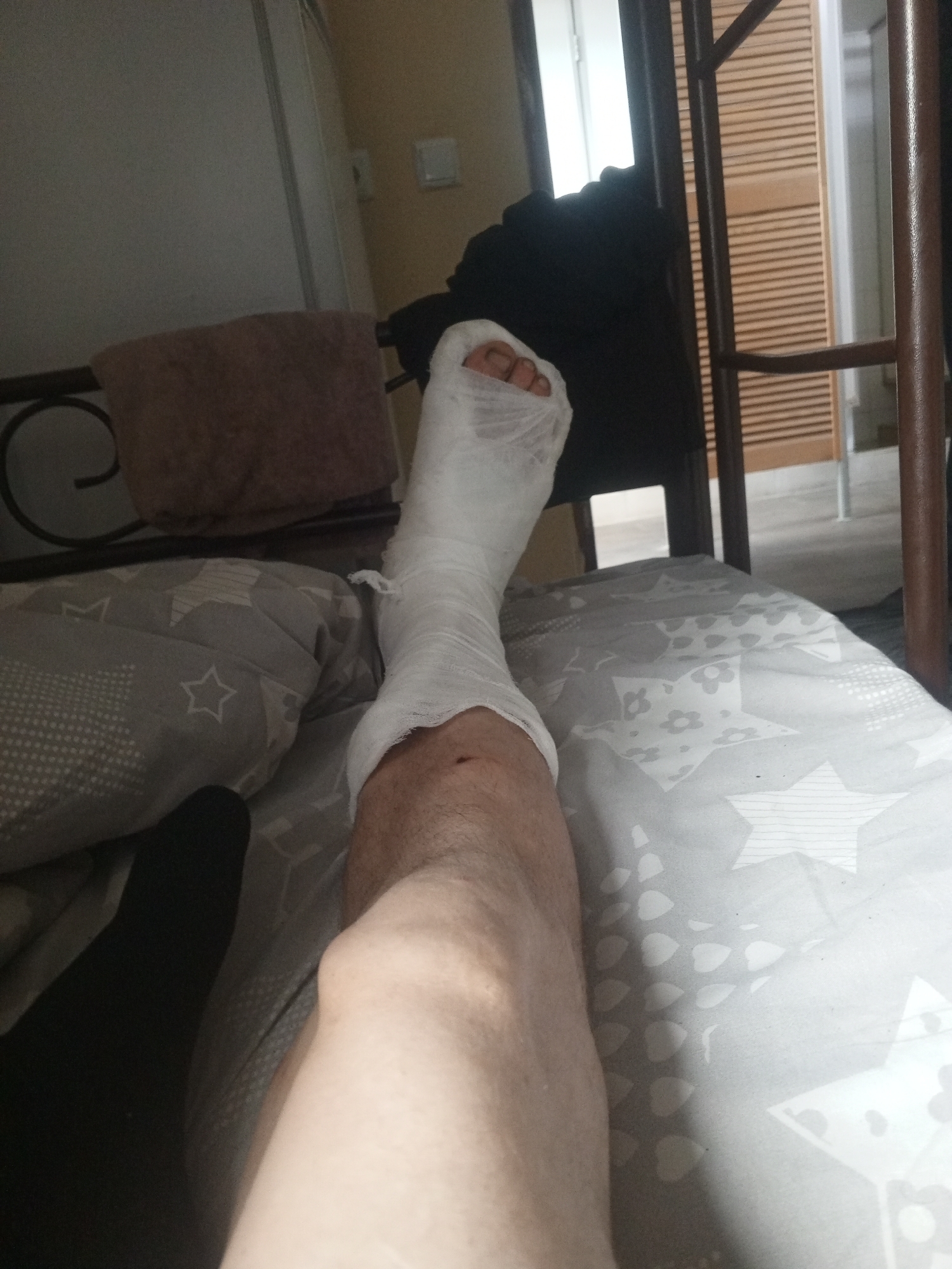 A person's leg, encased in a white medical cast from the toes to just below the knee, is the primary subject of the image. The leg rests on a bed with grey and white patterned bedding. A black sock or garment is visible on the lower part of the leg, contrasting with the pale skin. In the background, a dark fabric is draped over a metal structure, possibly a bed frame. The setting appears to be indoors, with a wooden-slatted door or partition visible in the distance. The image's composition suggests it was taken from a slightly elevated perspective, looking down at the leg. There is no indication of the city of Kyiv, Ukraine in the image.