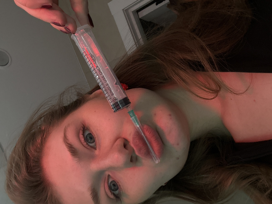 A close-up, selfie-style photograph depicts a young adult female indoors in Kazan, Russia. The subject has light brown hair with reddish tones and blue eyes, which are directed at the viewer. Her lips are pursed in an exaggerated "duck face" expression. She holds a clear plastic syringe with a green-capped needle in her right hand; her thumb and index finger, adorned with dark nail polish, are visible gripping the plunger end. The syringe is labeled with text including "SINGLE USE ONLY" and "SFM," and its plunger is fully extended, indicating it is empty. The capped needle tip rests upon her pursed lips. Small red earrings are visible. The background is indistinct, showing a recessed circular light fixture overhead and a partial white architectural element, possibly a door frame, to the right. The entire scene is bathed in a strong red light, imparting a reddish hue to the subject's skin and hair.