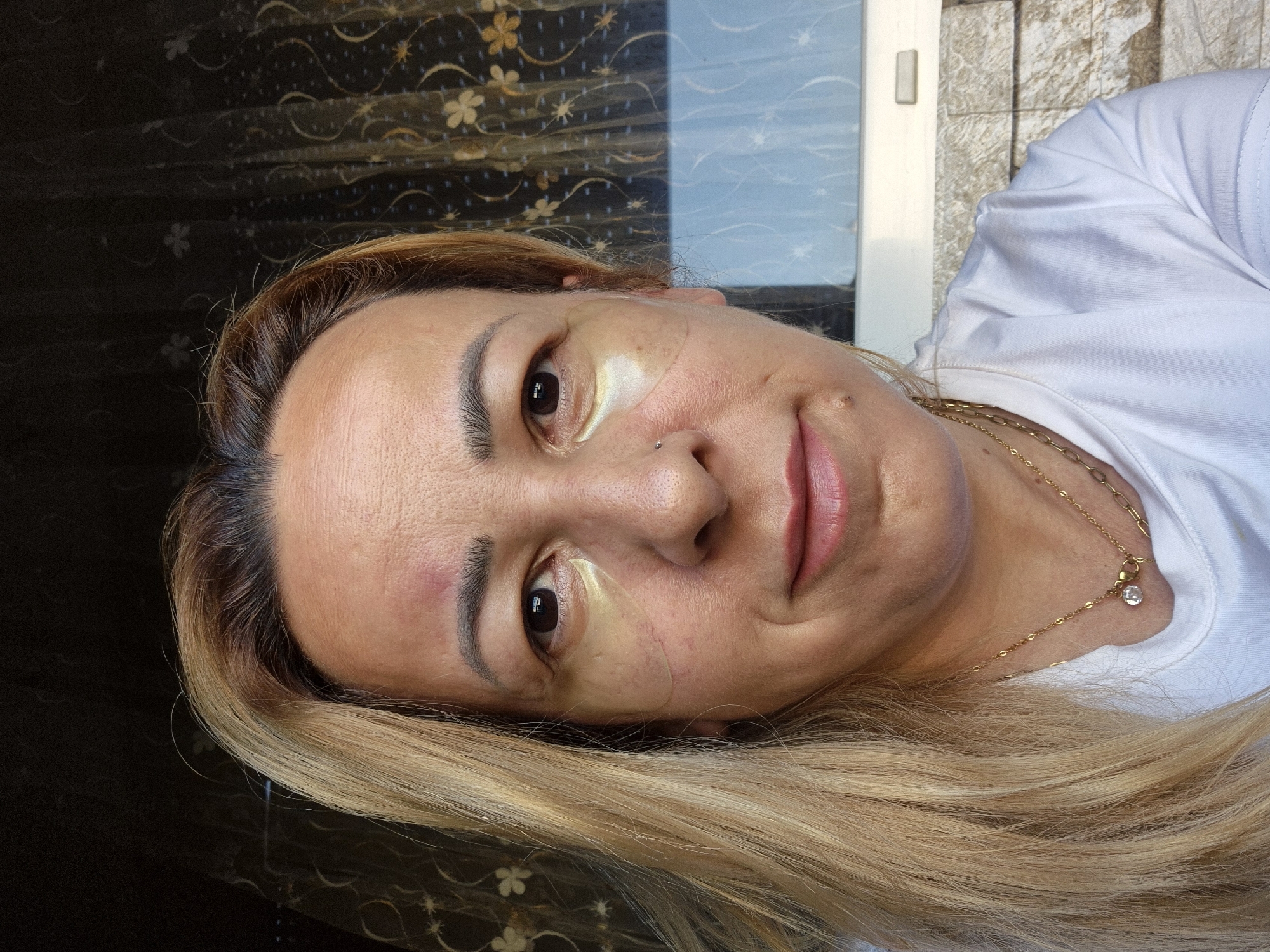 A medium shot captures a woman with blonde hair, wearing a white t-shirt and gold necklaces, as she looks directly at the camera. She has eye patches under her eyes, and a bruise is visible on her forehead above her left eyebrow. The background consists of a curtain with a floral pattern and a wall. The lighting suggests an indoor setting with natural light.