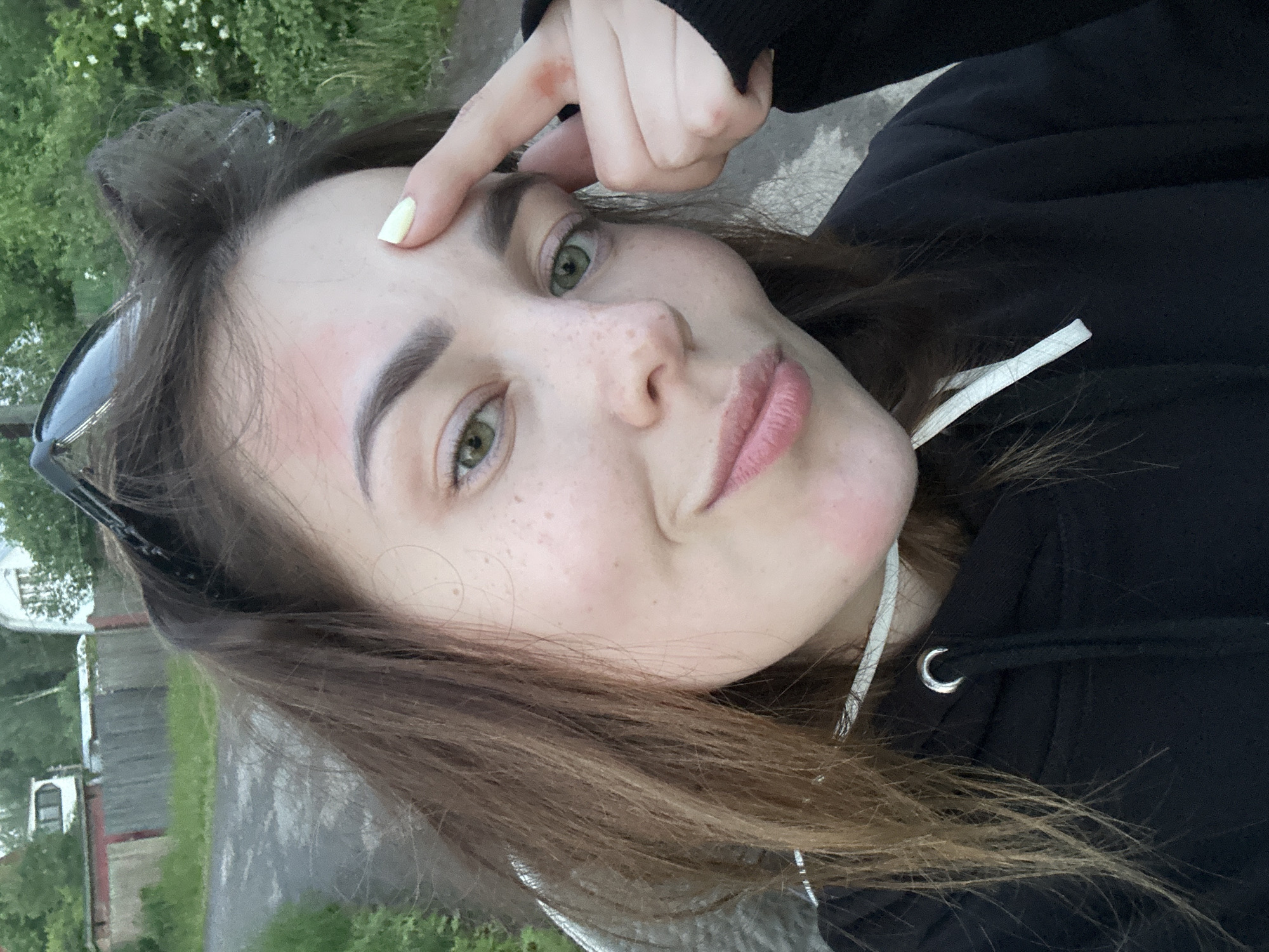A young woman with light brown hair and green eyes is taking a selfie outdoors. She is wearing a black hoodie with white drawstrings. Her right index finger is touching her forehead, where there is some redness. Her left hand is not visible. Behind her, there is a dirt path, green grass, a wooden fence, and some trees. In the background, a white building and a white vehicle are visible. The image appears to have been taken in Zhebrei, Russia.