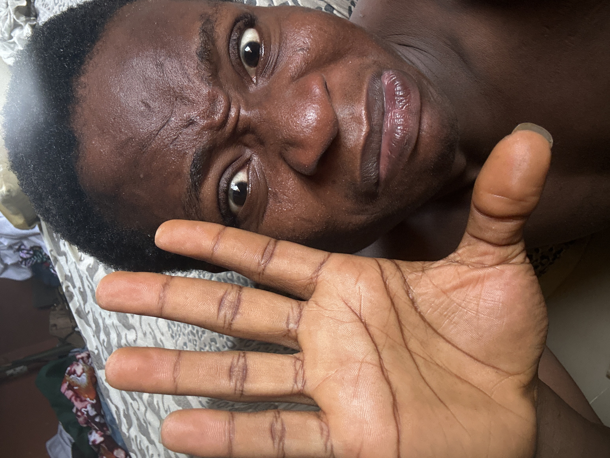 A close-up, low-angle photograph depicts a person with dark skin lying on a patterned surface, possibly a bed. The person's face is prominent, with a furrowed brow and wide eyes. The skin appears moist or sweaty. The person's right hand is held up in the foreground, palm facing the camera. The background includes fabric or bedding with a mix of patterns and colors. The location is identified as Unknown, Unknown.