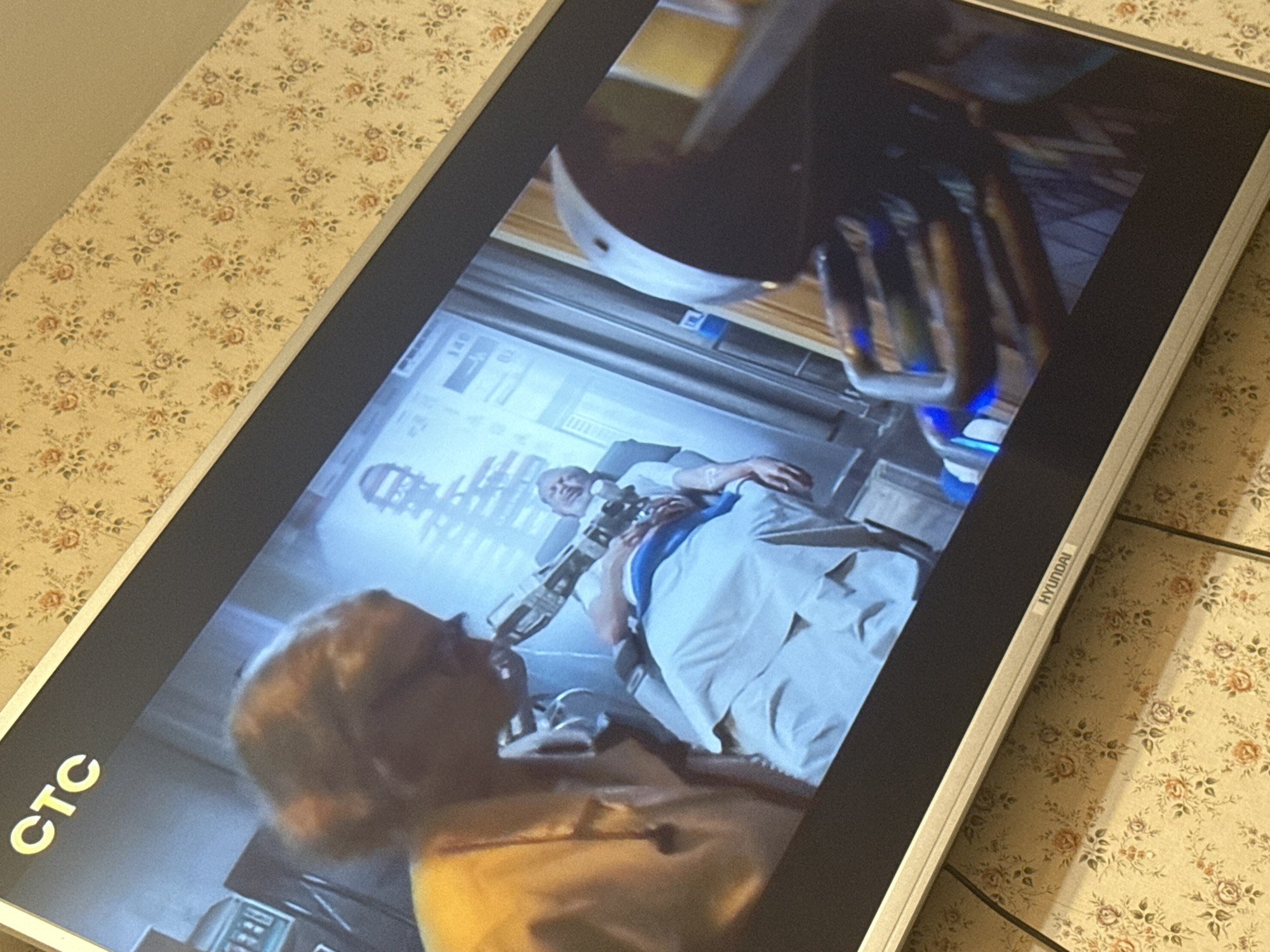 The image shows a close-up of a television screen displaying a scene from a movie or TV show. The scene depicts a medical or science fiction scenario involving a patient lying in a bed, possibly undergoing a procedure by a medical robot or advanced device. There are two people or characters visible. The setting seems to be a hospital room. The TV is a Hyundai brand, and the Russian TV channel CTC is visible in the corner. There is no information to suggest the location of the TV set is in the city of Mytishchi, Russia. The scene appears to be set in a hospital room. A man is on a hospital bed, covered with white sheets. A medical robot or mechanical device is shown being used on him. A person is in the bottom left corner.