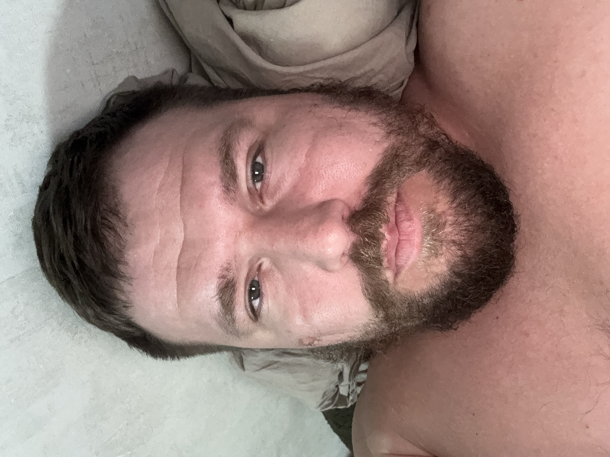 A close-up portrait of a man with dark hair and a full, dark brown beard is shown, oriented 90 degrees clockwise. The man is lying down, looking directly into the camera with a neutral expression and dark eyes. Notable facial features include visible forehead wrinkles and a small mark or scab located below his nose on his right cheek. His skin appears fair to medium with some areas of redness. He is shirtless, with a portion of his bare shoulder or chest visible towards the right side of the frame. The background features a light gray or off-white textured surface, likely a sheet or pillow, and a crumpled light brown or beige fabric, possibly a blanket, suggesting an indoor setting. The image provides no specific cues for the time of day or weather, beyond being indoors. No text is visible in the media file. This scene is set in Chaikovsky, Russia.
