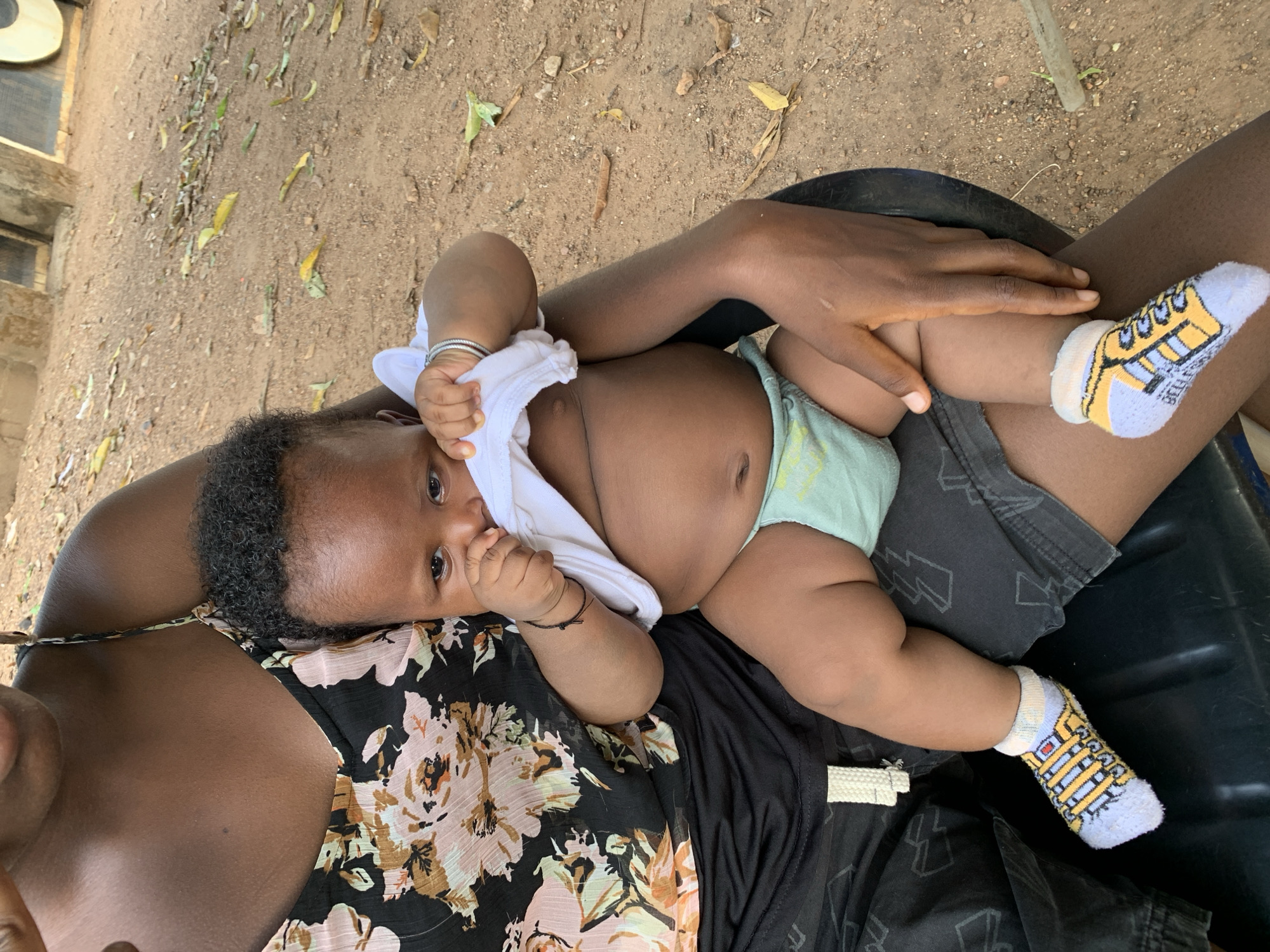 A baby lies in the lap of a person wearing a floral top and dark shorts. The baby wears a light green diaper and socks with a cartoon bus design. The person's hand rests on the baby's leg. The background shows dry earth and foliage. The location is Akwanga, Nigeria.