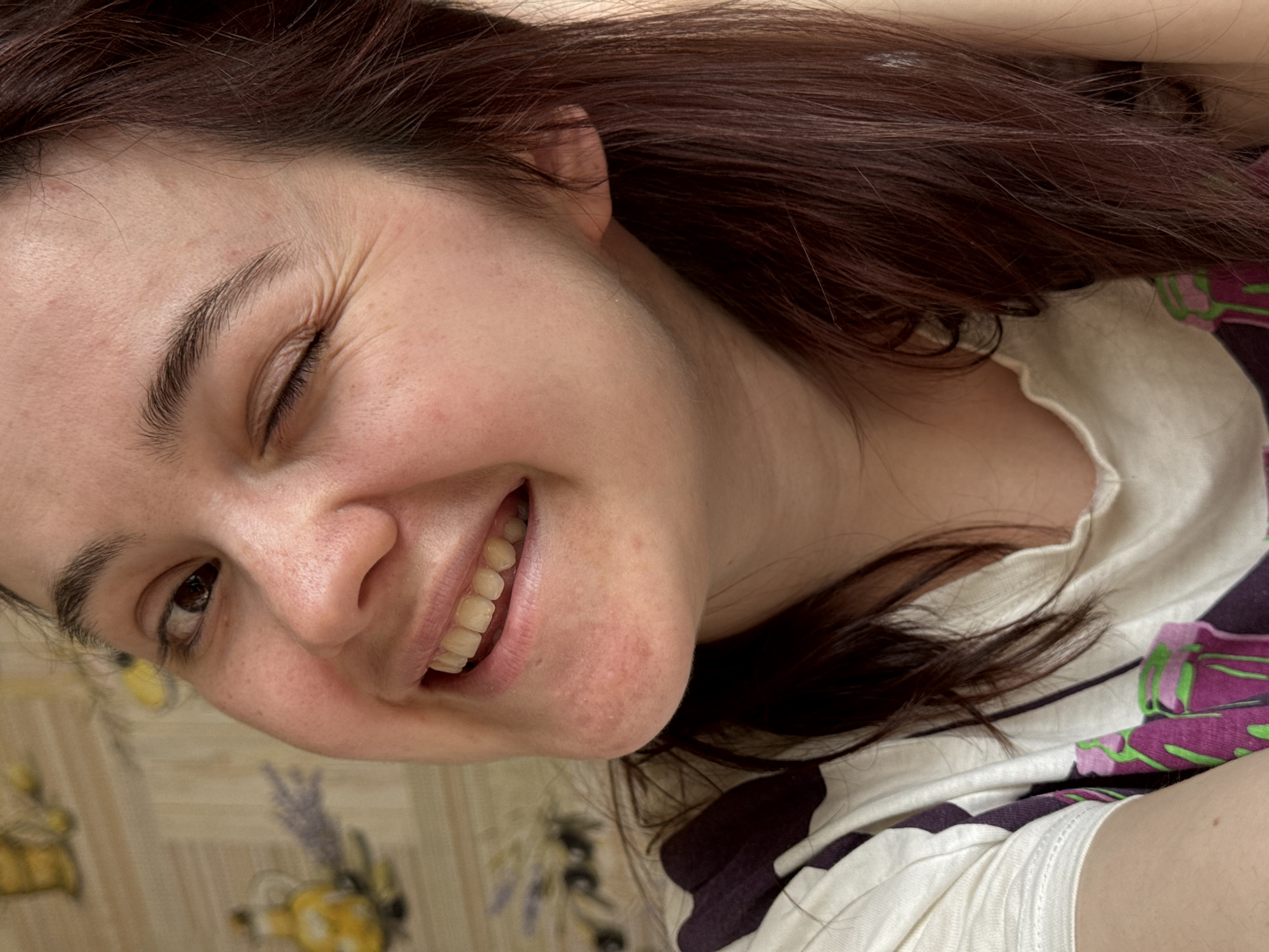 The media file features a close-up, tilted portrait of a young adult woman, likely taken indoors in Izhevsk, Russia. She has dark brown or auburn hair and fair skin. Her expression is joyful and playful, characterized by a broad smile that reveals her yellowish-white teeth, and a distinct wink with her left eye. Prominent crow's feet are visible around her winking eye, emphasizing the genuine nature of her smile.
She is wearing a white or cream-colored t-shirt with a vibrant purple and green floral or abstract pattern visible on her right side. Her body is positioned in a relaxed manner, possibly lying down or lounging.
The background consists of patterned textiles. Behind her head, a light-colored surface with a subtle ornamental design is visible. Below her, there's another fabric, likely a bedsheet or blanket, in light brown and beige tones with a discernible pattern of stylized flowers or lavender-like plants. Minor blemishes are visible on her skin, particularly on her forehead and chin, and her right eye is open, revealing a dark iris. No text is visible in the image.