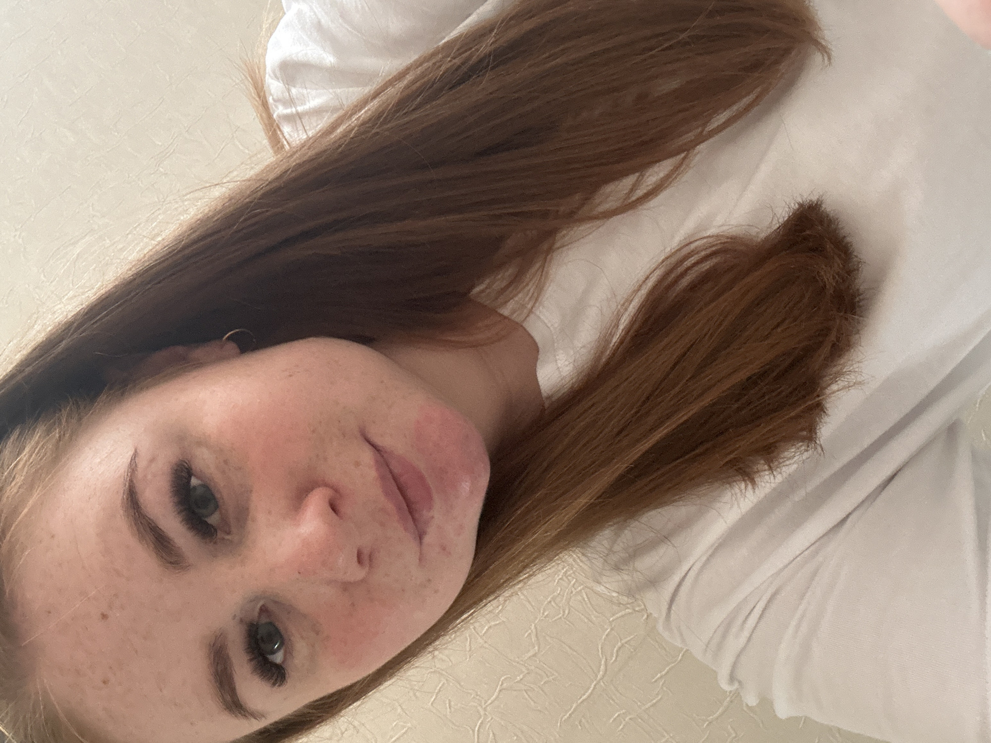 The media file presents a close-up, low-angle portrait of a young person, likely female, captured indoors in Chaikovsky, Russia. The subject has long, reddish-brown hair that flows around their head and shoulders, and a fair complexion with numerous freckles visible across their nose and cheeks.
They are wearing a simple white long-sleeved top. Notable facial features include dark, well-defined eyebrows and distinct eyelash extensions that enhance their green or hazel eyes. A small golden hoop earring is visible in the left ear (viewer's right). The person's lips are slightly parted, and there is visible redness or skin irritation on their chin and extending towards the jawline. The overall expression is neutral.
The background is a light-colored, textured surface, possibly wallpaper or a headboard, consistent with an indoor setting, likely a bedroom. The lighting is uniform, suggesting an indoor light source without indicating a specific time of day. The person appears to be posing directly for the camera. No visible text is present in the image.