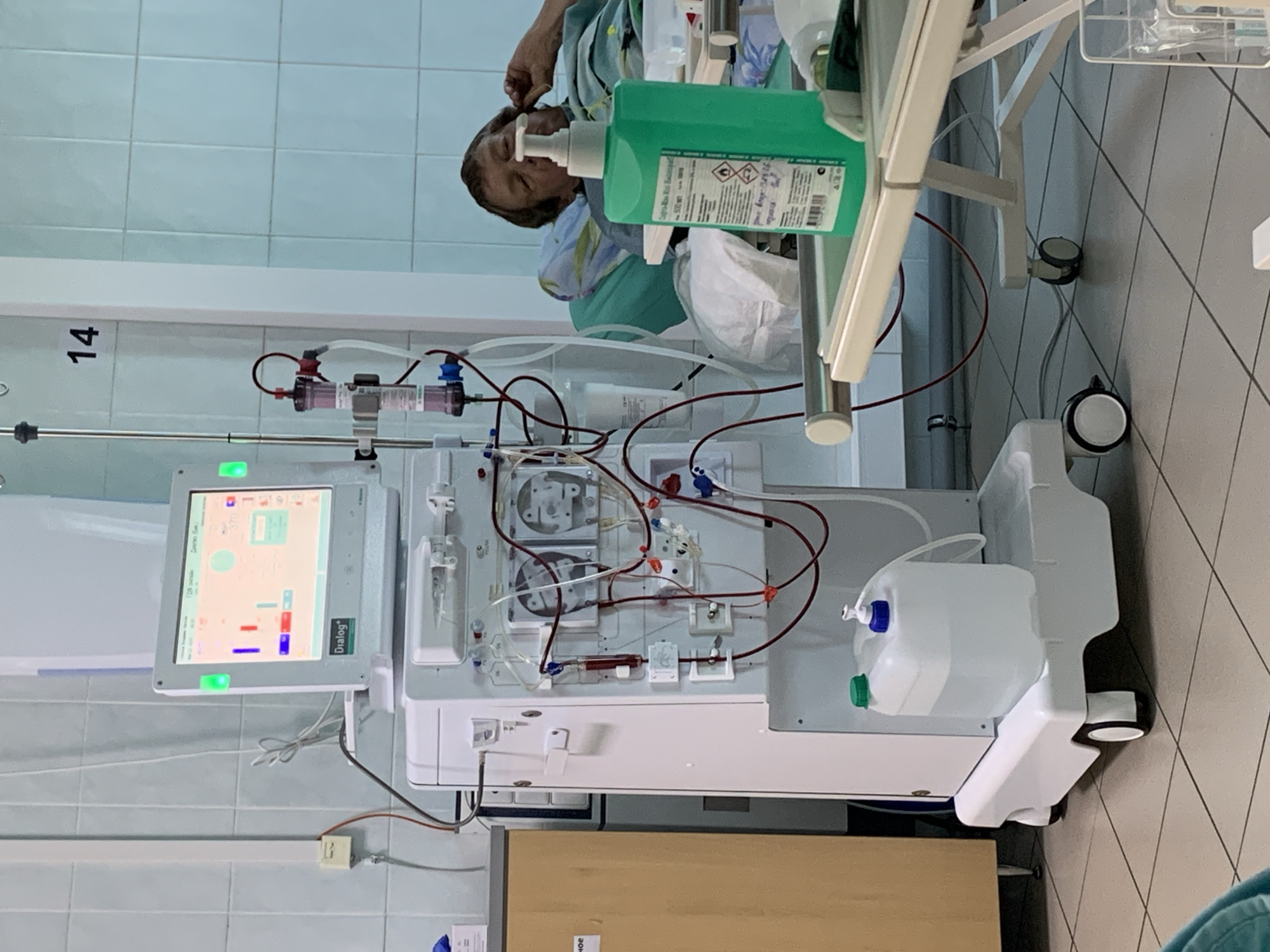 The image shows a hemodialysis machine in a room with tiled walls. The machine has a screen displaying information and is connected to various tubes and containers. A person is lying in a bed nearby, possibly a patient undergoing dialysis. A bottle of hand sanitizer is visible on a table next to the machine. Based on the presence of the Dialog+ dialysis machine, it is possible this image was taken at a hospital or clinic that offers dialysis treatment. It is not possible to confirm the exact location without additional information.