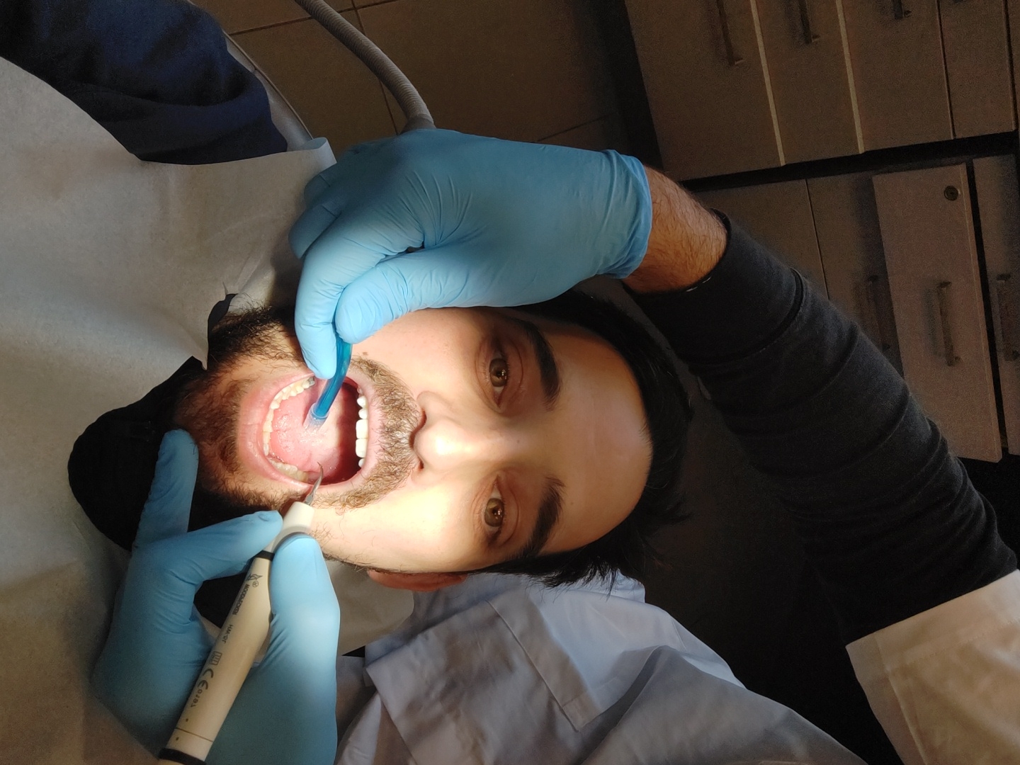 A dental hygienist is performing a dental cleaning on a male patient. The patient is lying in a dental chair with his mouth open. The hygienist is wearing blue gloves and using a dental scaler to remove plaque and tartar from the patient's teeth. A suction device is positioned in the corner of the patient’s mouth. The image does not contain any information that would identify the location as Tel Aviv, Israel.
