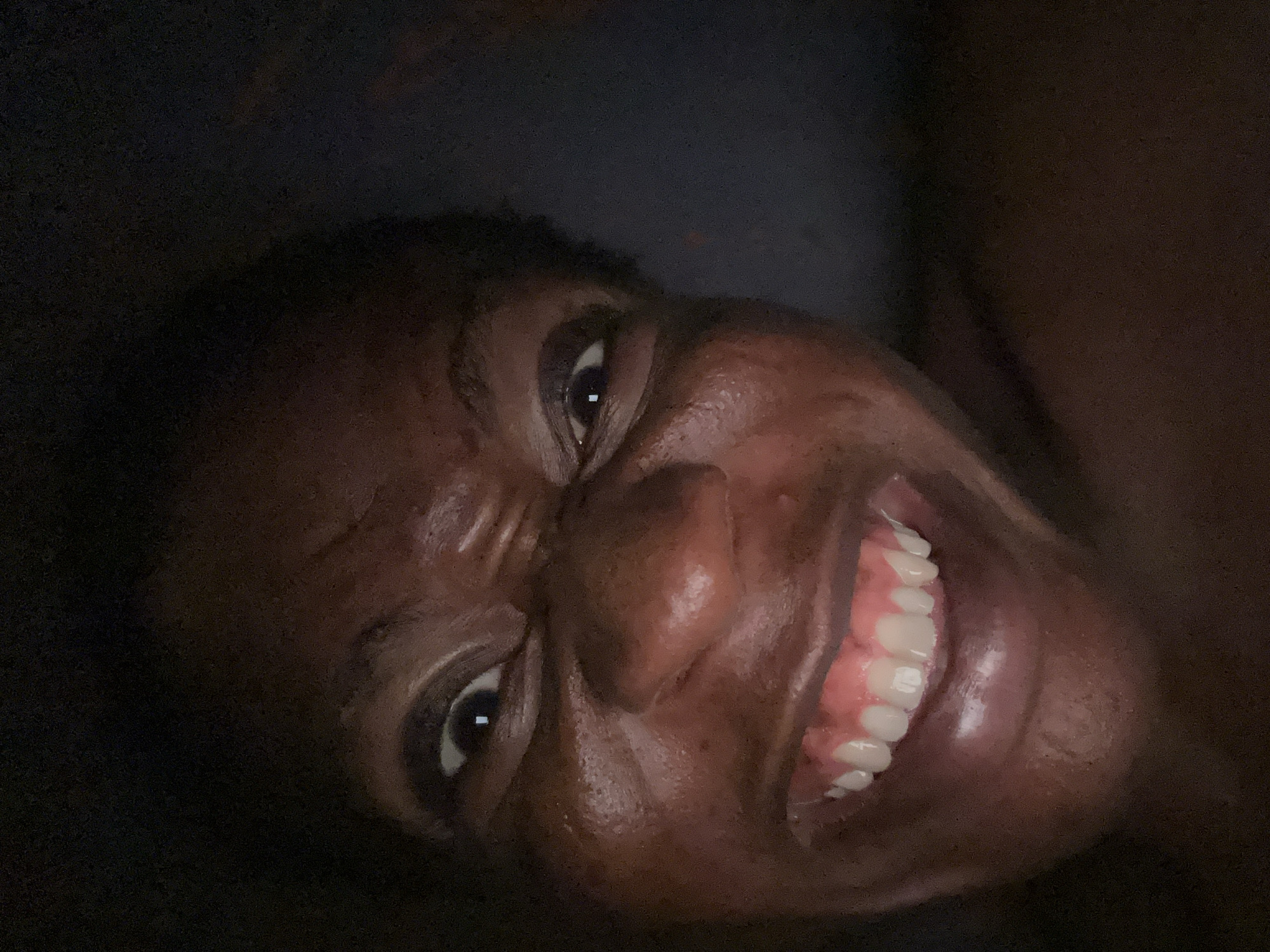 A close-up, slightly rotated image shows a person with dark skin smiling widely, revealing white teeth. The person's eyes are narrowed, and facial features are highlighted with visible skin texture and minimal shadows. The background is dark and mostly out of focus. The location in the city of Unknown, Unknown is not discernible.