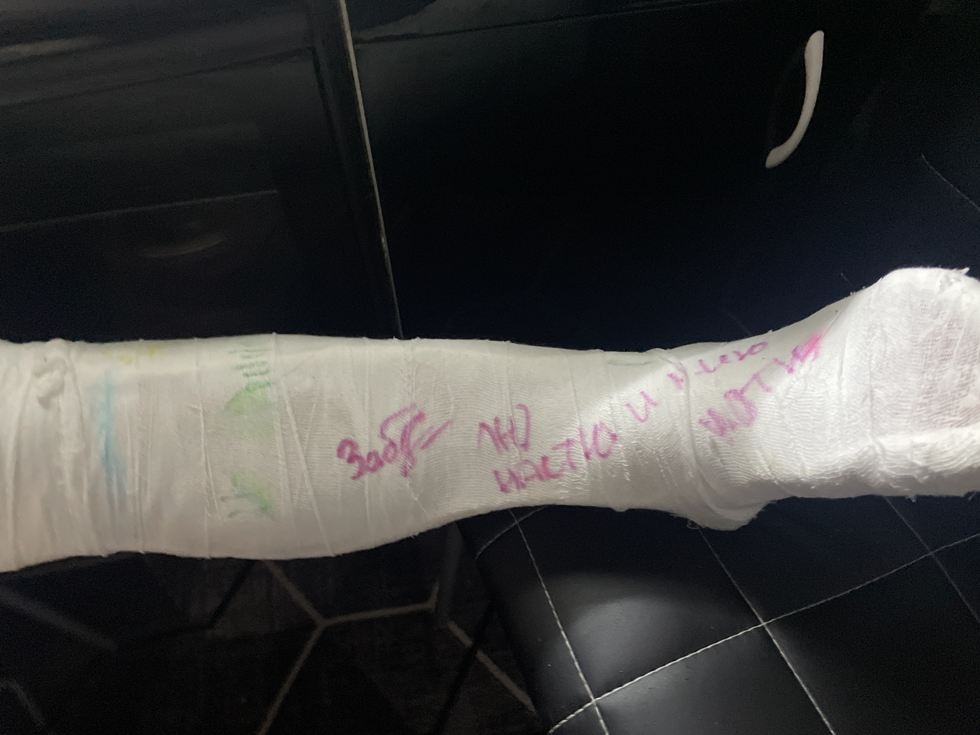 The image shows a person's arm in a white cast, likely an orthopedic cast due to a fracture. The cast has messages written on it in pink marker, including the words "Забудь," "NO," and "HALTIA U VERA." The background suggests the arm is resting on a dark surface, possibly a chair or couch, as the environment surrounding the arm indicates it is inside, potentially a residential or medical setting. The image was captured in Chaikovsky, Russia.