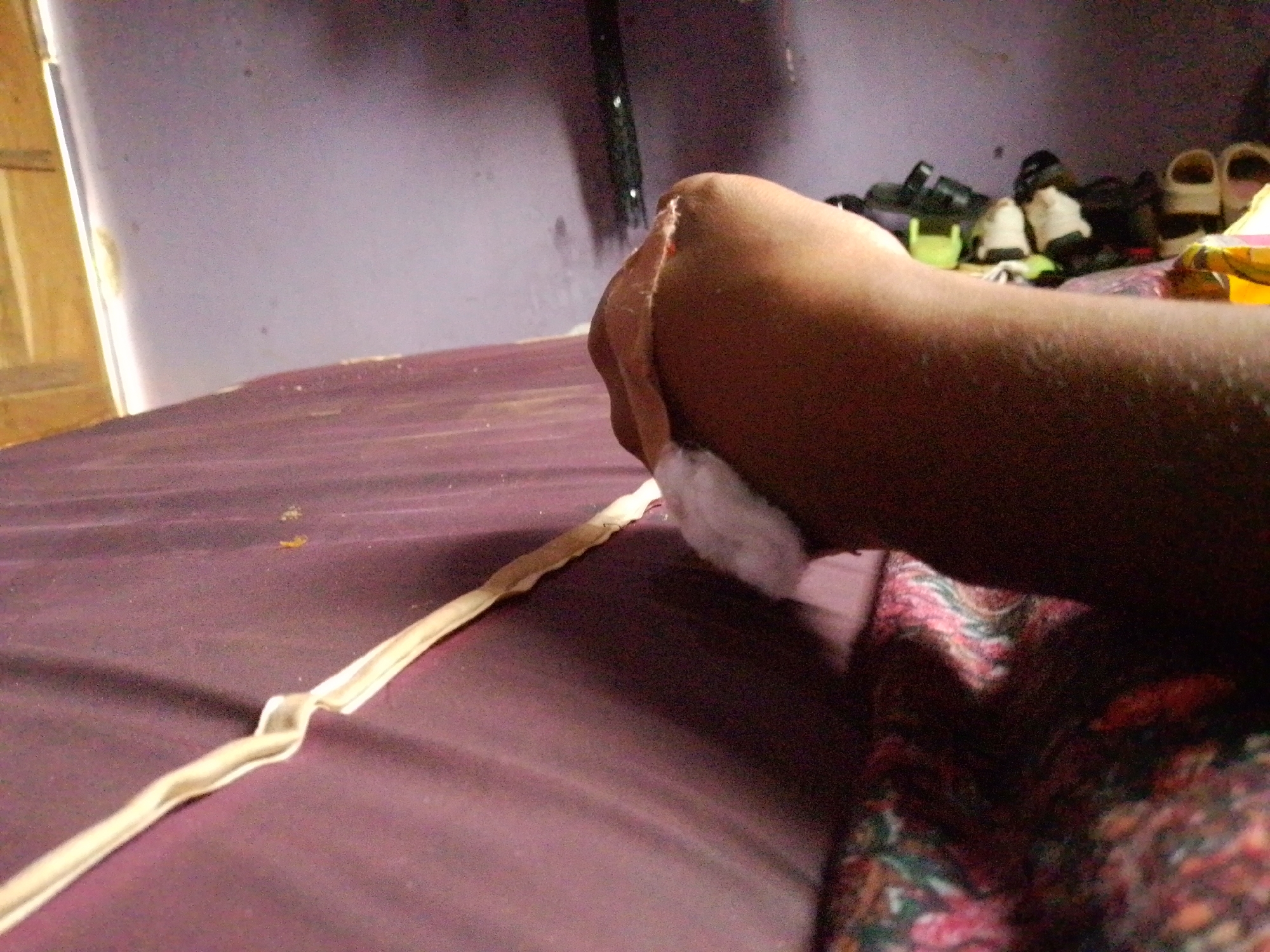 In Nsukka, Nigeria, a person's arm and hand are visible in the foreground, resting on a dark purple surface, possibly a bed or mattress. The arm appears to be dark-skinned. A white, soft material is wrapped around the wrist area, and a visible wound or incision is present on the back of the hand, with what appears to be a small amount of blood. A beige ribbon or cord runs diagonally across the surface from the bottom left to the middle right of the frame, near the hand. In the background, a purple wall is visible, with several pairs of shoes and other objects placed on the floor or a shelf against the wall. The lighting is dim, with light coming from the left side of the image.