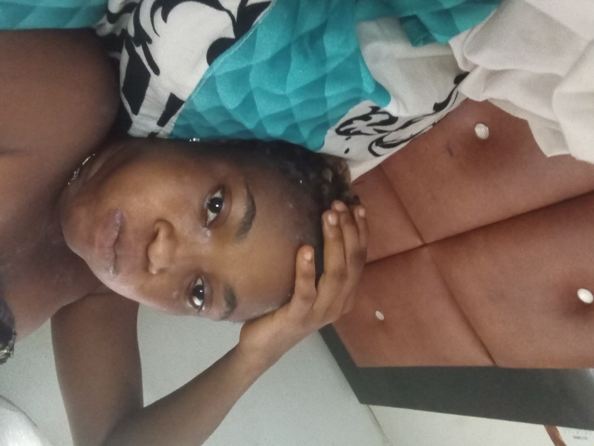 A young Black woman is lying down with her head propped up on her hand. She is looking at the camera. She has short, braided hair. She is lying under a blanket or sheet with a blue and white pattern. She is in a room with a light-colored wall and a headboard with buttons. The location is Unknown, Unknown.