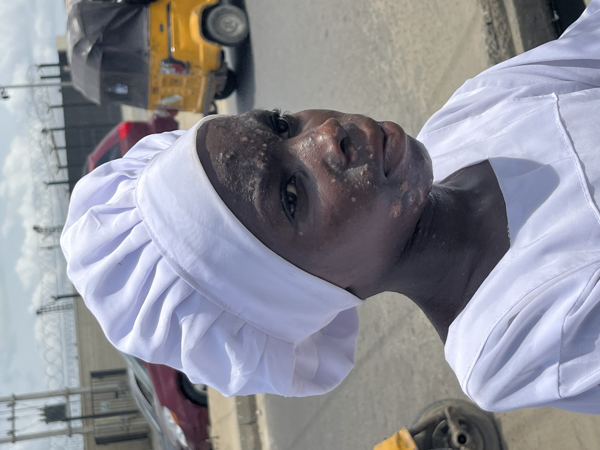The image shows a close-up of an African woman wearing a white head covering and white clothing. Her skin exhibits discoloration. She is outdoors in what appears to be a street in Ado, Nigeria. Behind her, partially visible, are vehicles (including a yellow tricycle taxi), a building with a barbed wire fence, and other street-level elements.