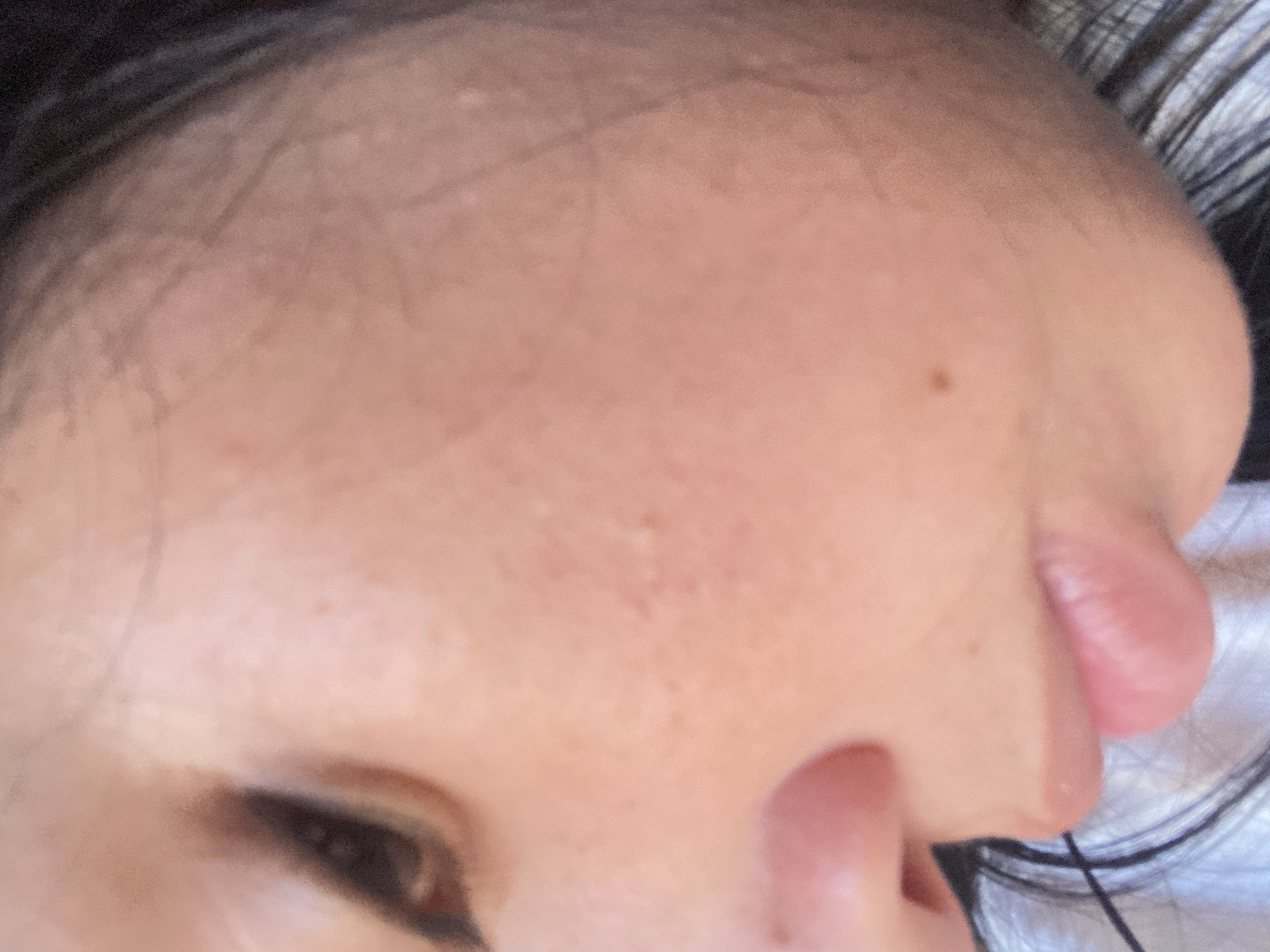 A close-up photograph shows a person's face, angled towards the camera from the left. Visible features include part of an eye with dark lashes, a section of the forehead with fine lines and a small mole, the nose, and a portion of the upper lip. Dark hair is visible along the upper edge of the forehead and near the lower right corner. The background is out of focus. There are no indications regarding the location in the city of Juan Griego, Venezuela.