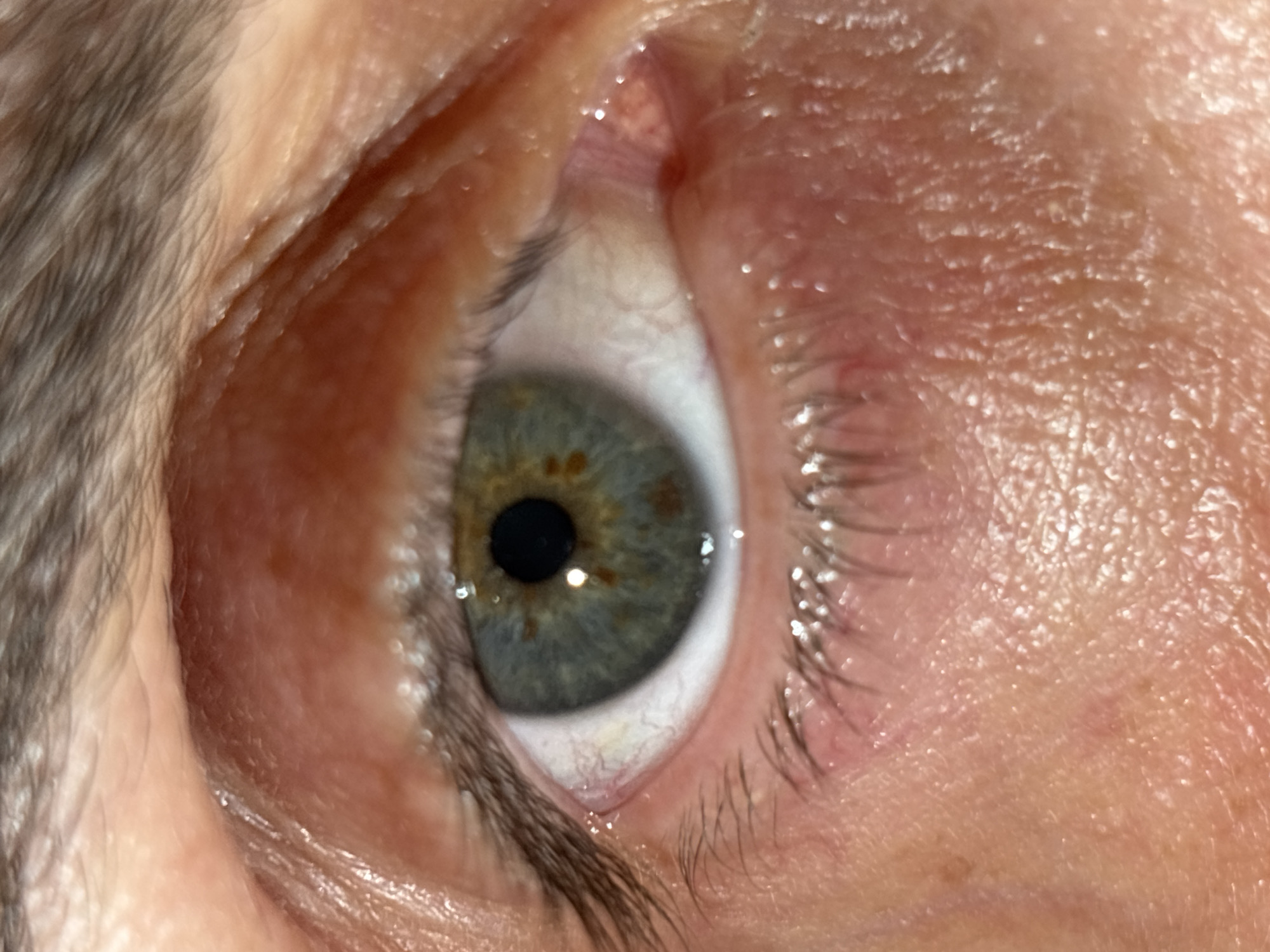 A close-up image of a human eye is presented. The iris is a mix of grey, blue, and green, with brown flecks near the center. The pupil is black and dilated. Fine lines and wrinkles are visible on the surrounding skin. Eyelashes are present on both the upper and lower eyelids. Small veins are visible in the sclera (white part) of the eye. There is no indication of the location being Tbilisi, Georgia.