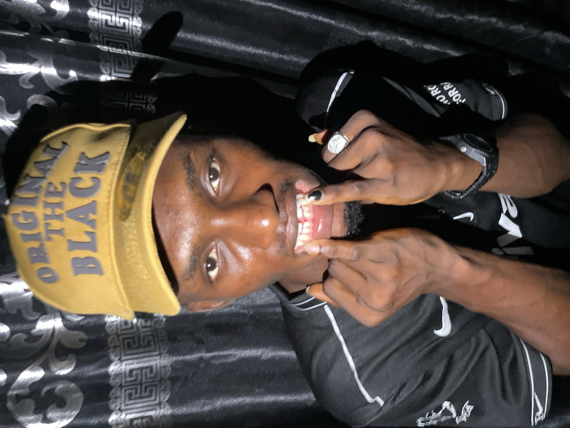 A close-up, medium shot features a Black man wearing a yellow baseball cap with the words "ORIGINAL THE BLACK" on it, a black shirt, and a black watch. He has a silver ring on his left hand and black nail polish on some fingers. He is using both hands to expose his teeth. The background is a black and silver patterned fabric. The location is purported to be Lokoja, Nigeria, but there is no visual evidence in the image to confirm that.
