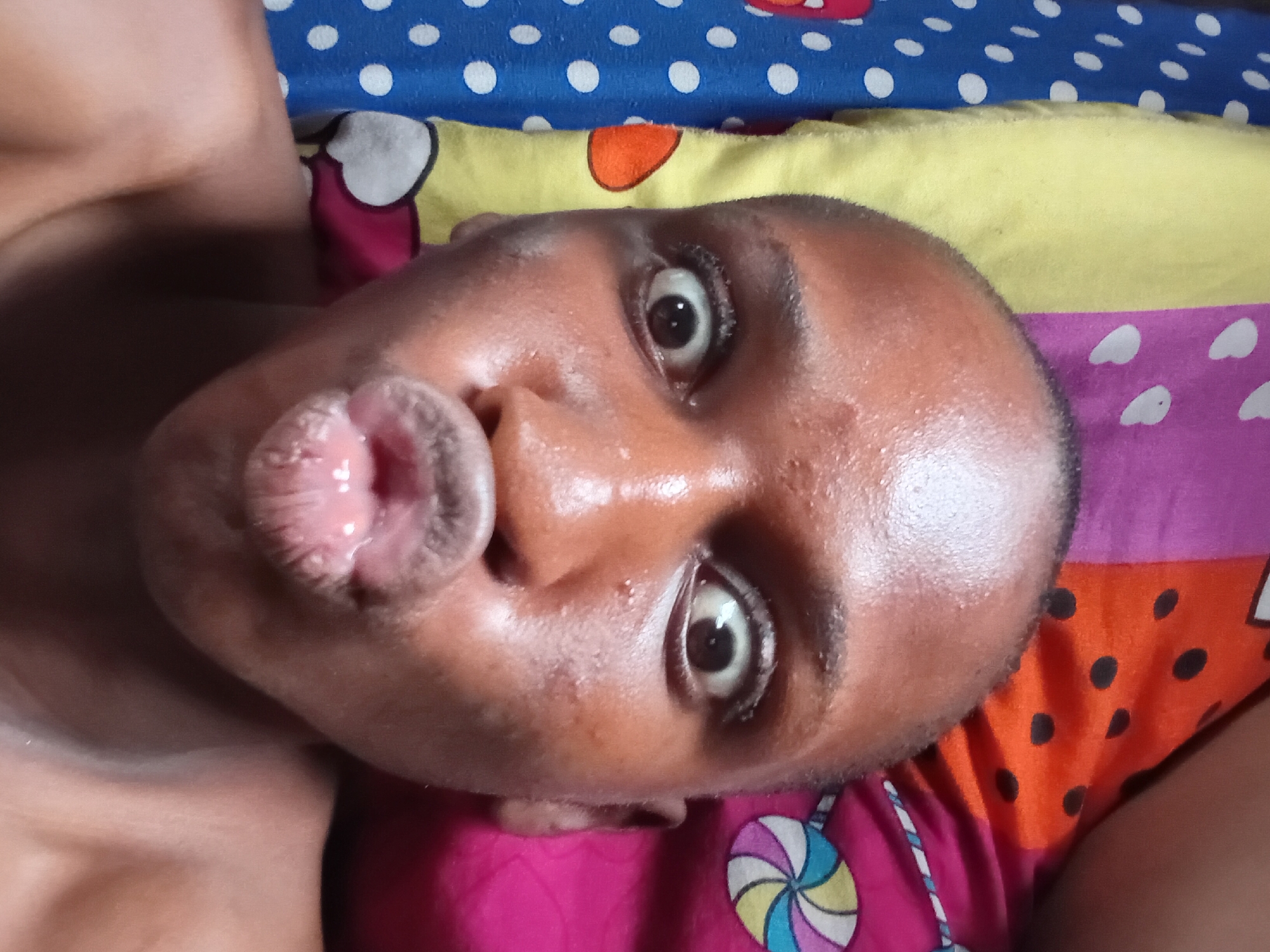 This media file is a close-up, overhead shot of a child lying on a bed. The child has dark skin and is making a "duck face" with their lips pursed. Their eyes are open and looking directly at the camera, appearing wide. The child's skin appears shiny, possibly from sweat.
The child is lying on a bed with colorful, patterned bedding. The top layer of the bedding is blue with white polka dots. Below that is a yellow section with what appear to be cartoon hearts in pink and orange. The bottom visible section of the bedding is pink with white hearts and a colorful lollipop pattern.
The lighting suggests it is daytime, likely indoors. The overall mood seems playful or mischievous due to the child's facial expression. There is no visible text in the image. The location context is Nkpor, Nigeria.