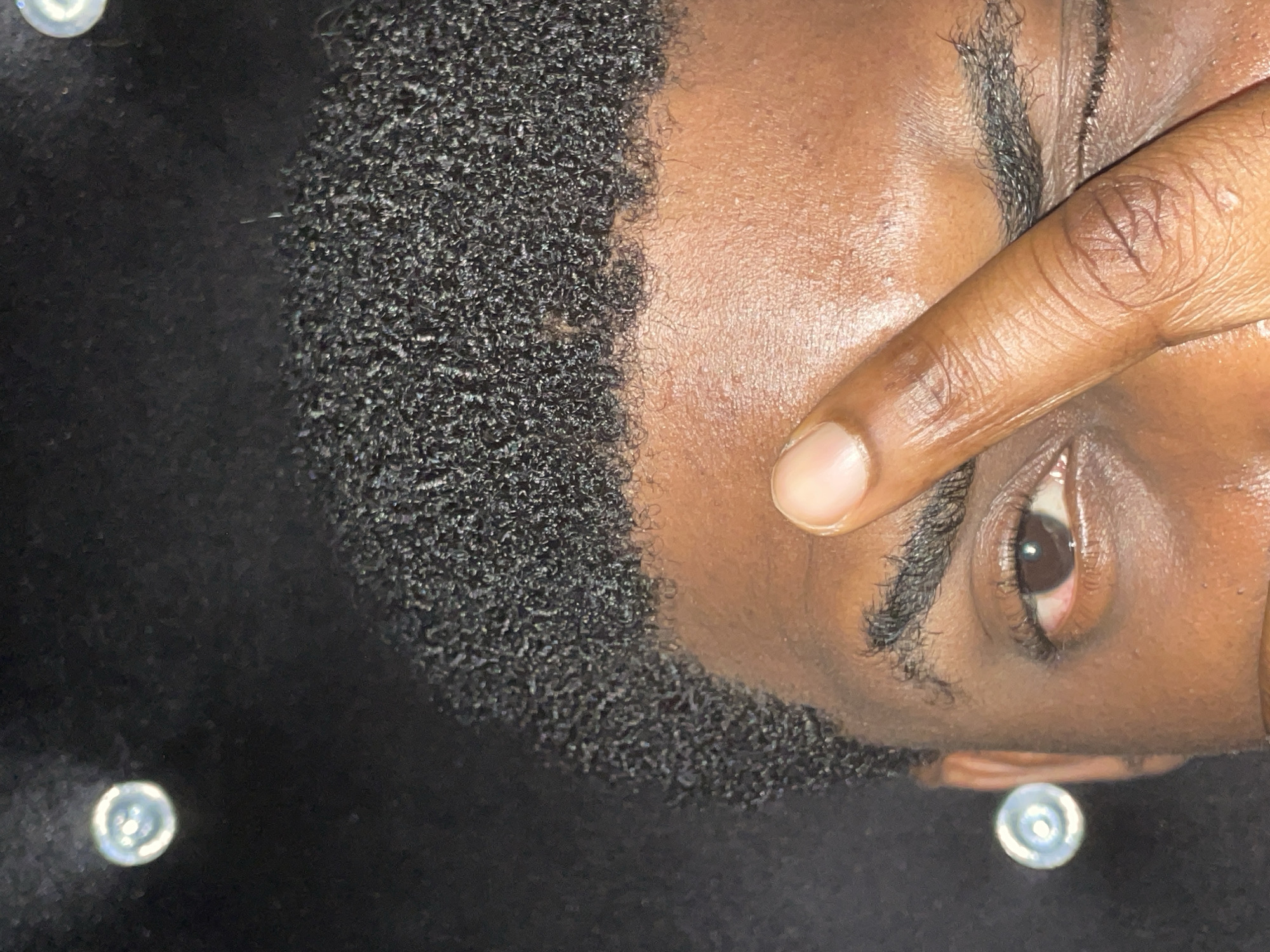 A close-up, rotated portrait shows a Black man with short, dark, tightly curled hair. His dark skin appears shiny. He covers part of his forehead and one eye with his right index finger. The visible eye is brown. The background is dark, possibly a black fabric surface, with two silver-colored buttons visible. There is no indication of the city of Akwanga, Nigeria.