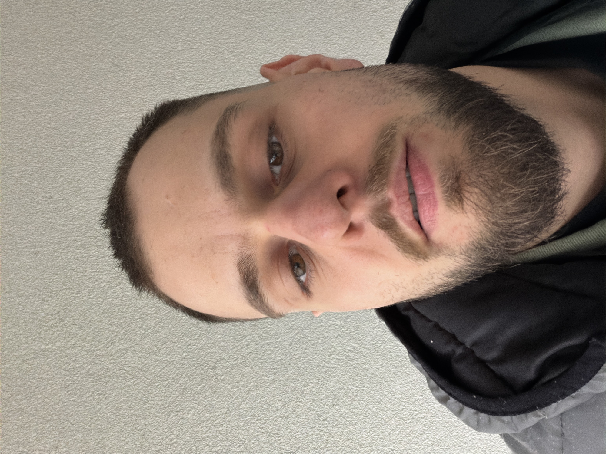 A man is centered in the frame, facing the camera directly, with the image rotated to the side. He has short, dark hair, light skin, a beard, and brown eyes. A scar is visible on his forehead. He is wearing a black jacket with a gray lining. The background is a plain, light-colored wall. The location is not discernible from the image provided.