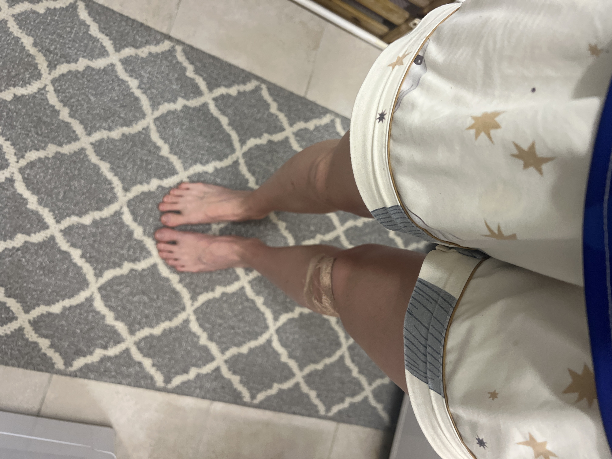 A top-down, close-up view shows a person's lower legs and feet standing on a patterned gray and white rug. The person is wearing shorts with a star pattern. A bandage is visible on the person's left knee. The flooring around the rug appears to be light-colored tile. The exact location in the city of Perm, Russia, cannot be determined from this image.