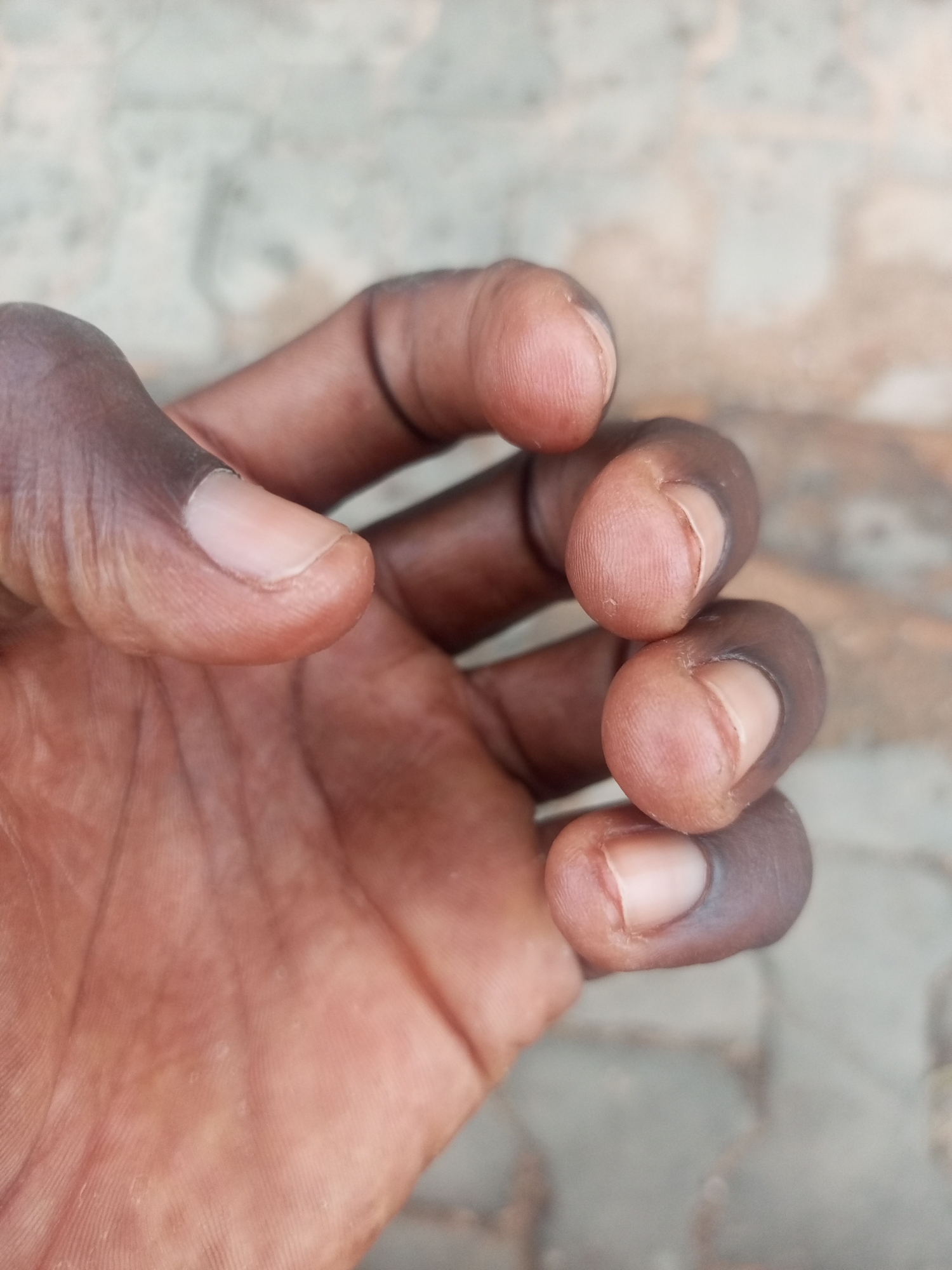 The image shows a close-up of a dark-skinned hand. The hand has four fingers visible, curled inwards. The fingernails are short and unpainted. The skin is marked with lines and wrinkles. The background is blurred and appears to be a textured surface. The location is potentially in Gombe, Nigeria.