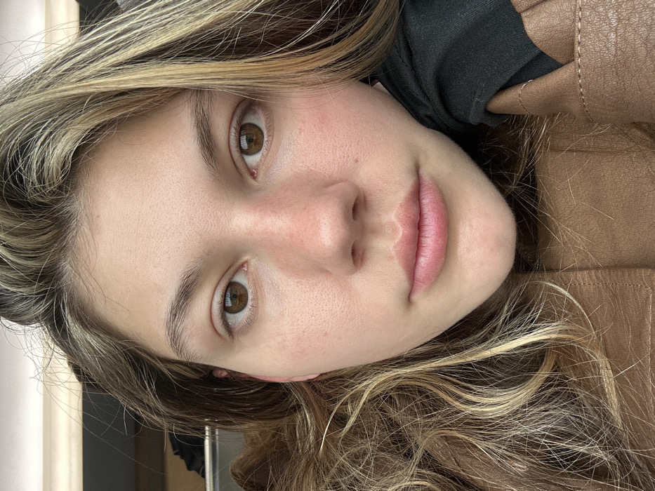 The scene depicts a close-up, frontal portrait of a young adult female, identified as being located in Zhangjiagang, China. The subject possesses fair skin, prominent brown eyes, and natural light brown hair with blonde highlights, which appears somewhat tousled. Her expression is neutral, with her gaze directed straight into the camera. A slight redness is visible on the bridge of her nose and cheeks. She is wearing a tan or light brown jacket, likely made of leather or faux leather, with a black sleeve or garment visible on the right side, supporting her head. The background is out of focus, suggesting an indoor setting with indistinct light and dark elements. No other individuals or specific objects are discernible.