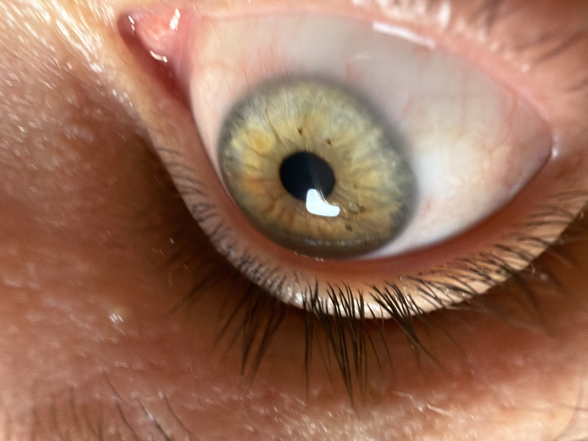 A close-up image shows a human eye with a light-colored iris containing some darker spots. The pupil is black and reflects light. Eyelashes are visible along the lower eyelid. The surrounding skin shows pores and hair follicles. The image lacks contextual information to identify the location as North Kuta, Indonesia. No other people, objects, actions, or interactions are visible.