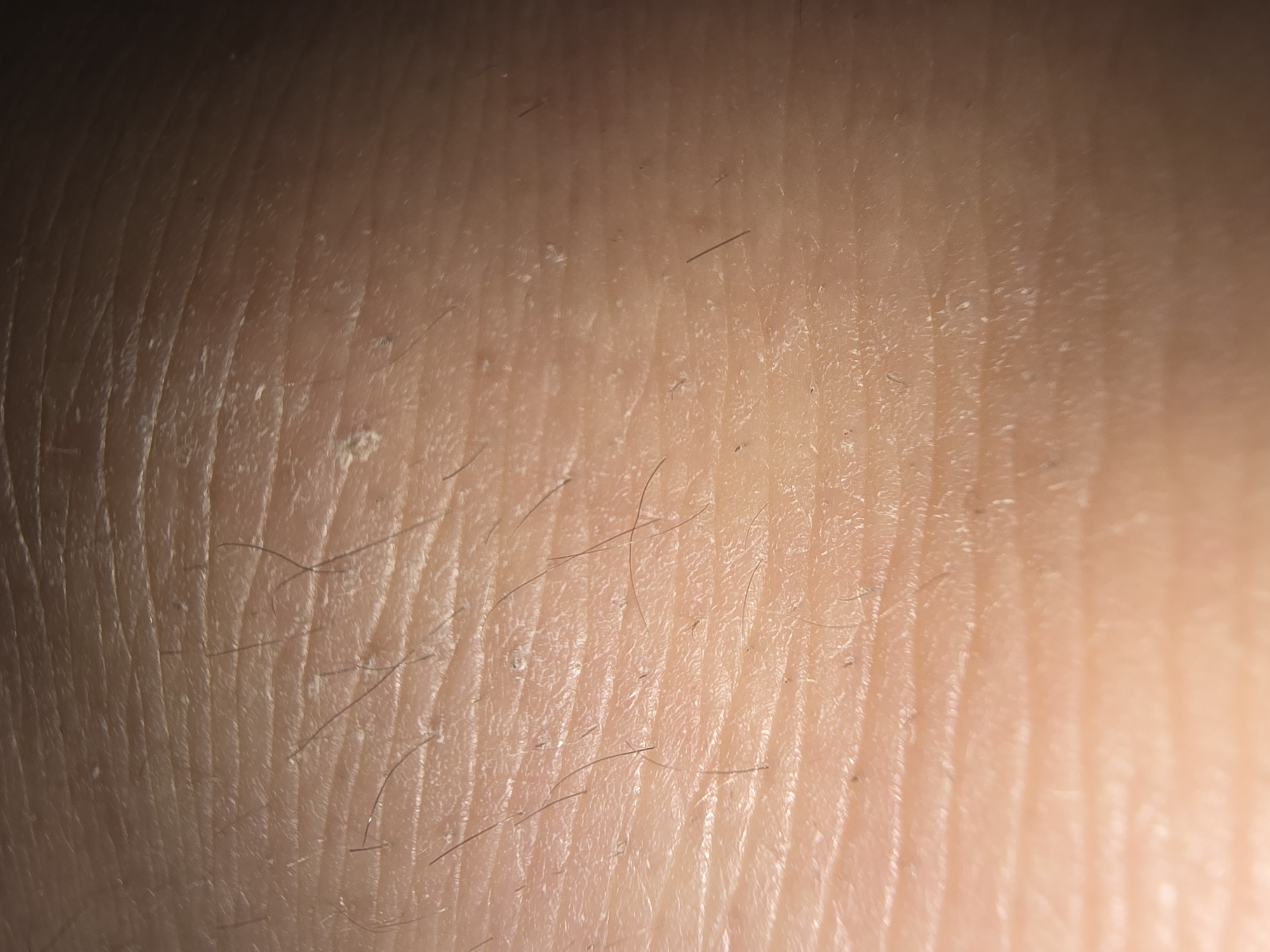 This is a close-up, macro photograph of human skin. The skin is light-toned and displays a textured surface with visible pores and fine lines or wrinkles running horizontally across the frame. Several fine, dark hairs are scattered across the skin's surface. There are also small, scattered white flakes or dry patches visible, particularly in the center and lower portions of the image. The lighting appears to be direct, creating highlights and shadows that emphasize the skin's texture. The background is a soft gradient of light and shadow, suggesting a curved surface. There is no indication of any specific location in Ulan-Ude, Russia, or any other urban environment. The image is purely a detailed examination of skin texture.