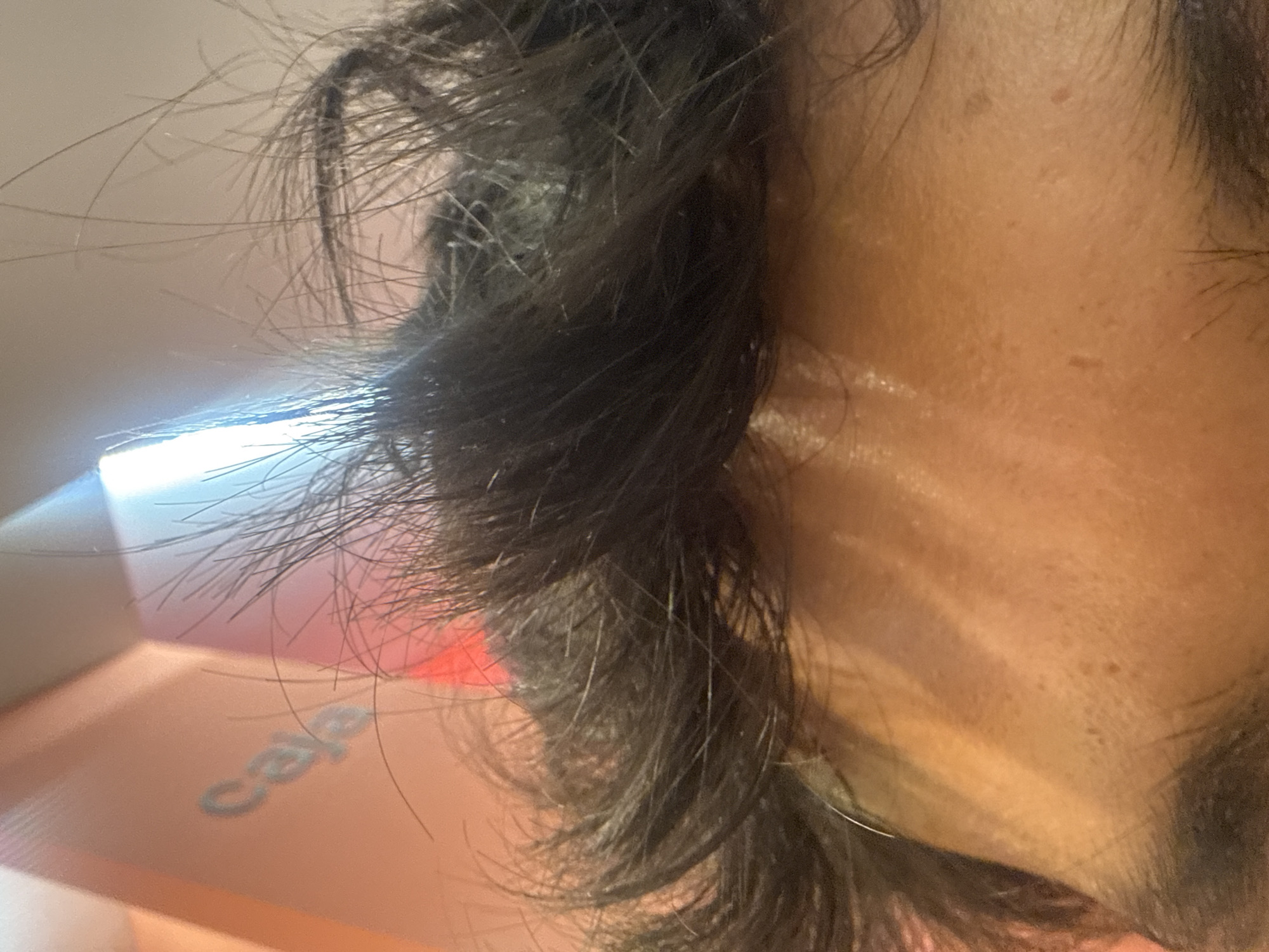 A close-up, slightly distorted image features a person's face, partially obscured by dark, messy hair. The skin is light brown with visible pores and minor blemishes. Sunlight creates stark shadows across the face. Part of an object with the word "caja" is visible at the lower left. The location in the city of San Bernardino Tlaxcalancingo, Mexico cannot be determined from the image.