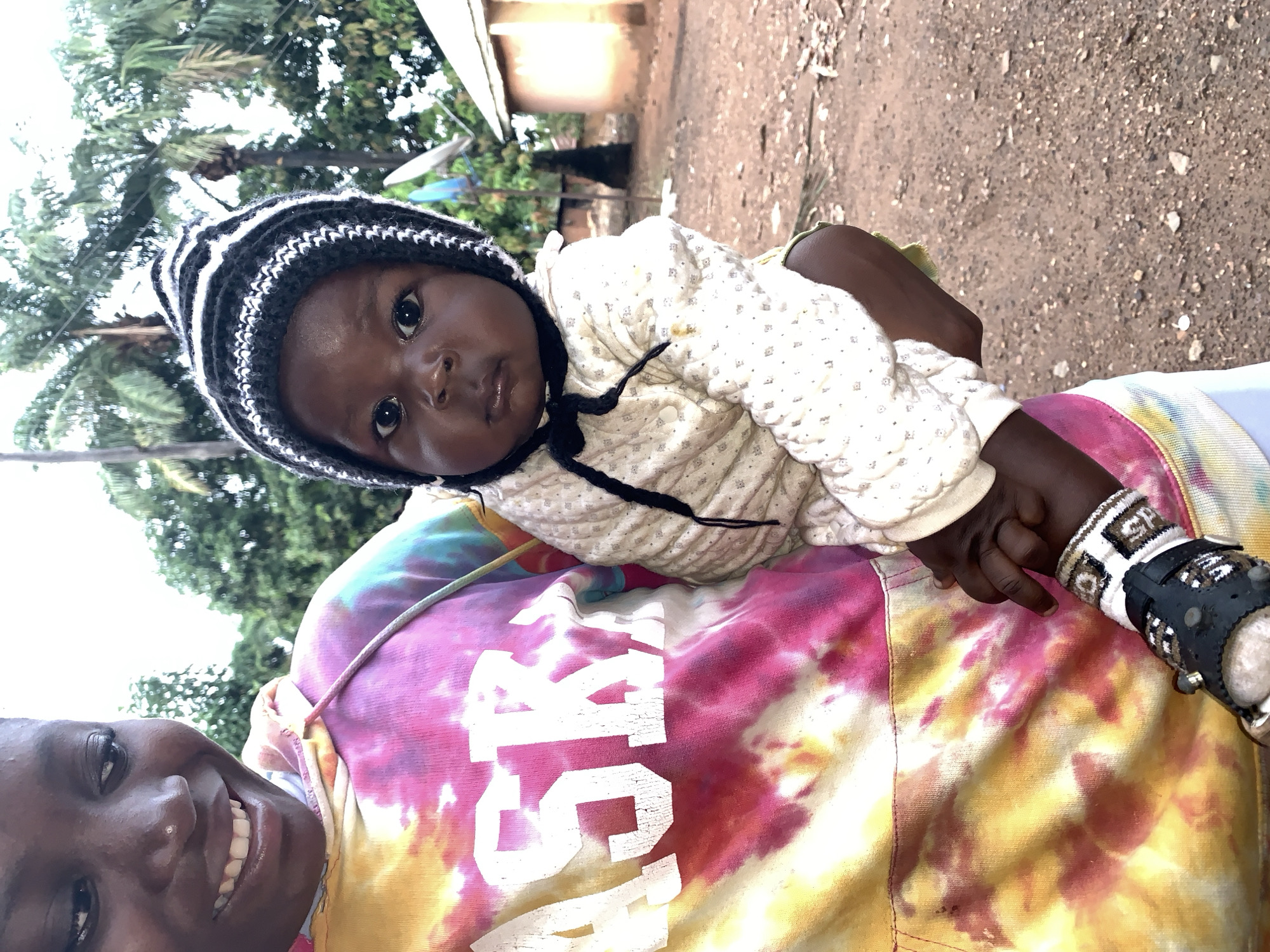 A close-up shot depicts a woman holding a baby outside in Akwanga, Nigeria. The woman is wearing a tie-dye sweatshirt with the word "ASK" printed on it and is smiling at the camera. The baby is wearing a white patterned sweater and a black and white striped hat with black ties. The baby is lying on the woman's shoulder and looking directly at the camera. The baby has a decorated white bracelet on its left hand, and a dark medical splint on the same wrist. The background shows a dirt road, green trees, and a small building. A satellite dish is visible in the background.
