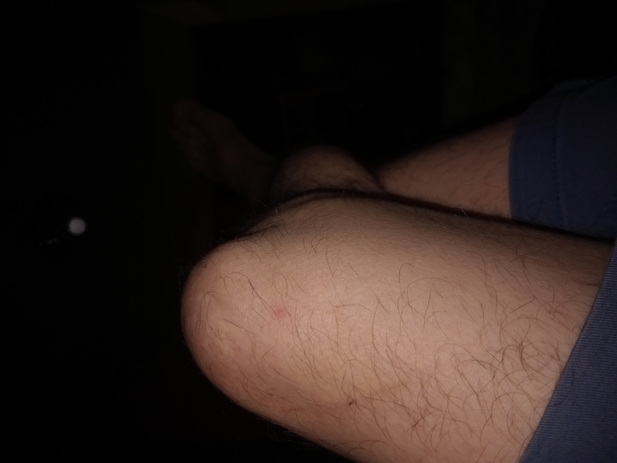 The image shows a close-up view of a person's legs in a dark environment, with the primary focus on the knee and surrounding skin. The skin is lightly tanned and covered with short, light brown hair. There is a small, reddish mark on the knee cap, possibly a scratch or a pimple. The lower part of the image shows a glimpse of dark blue fabric, likely shorts or pants, at the bottom edge. The background is predominantly black, with a faint, out-of-focus circular light source visible in the upper center of the image. The image is taken from a low angle, looking upwards at the legs. The overall scene suggests a casual, indoor setting. The location in Cotiujenii Mari, Moldova, cannot be determined from the visual information provided in the image.