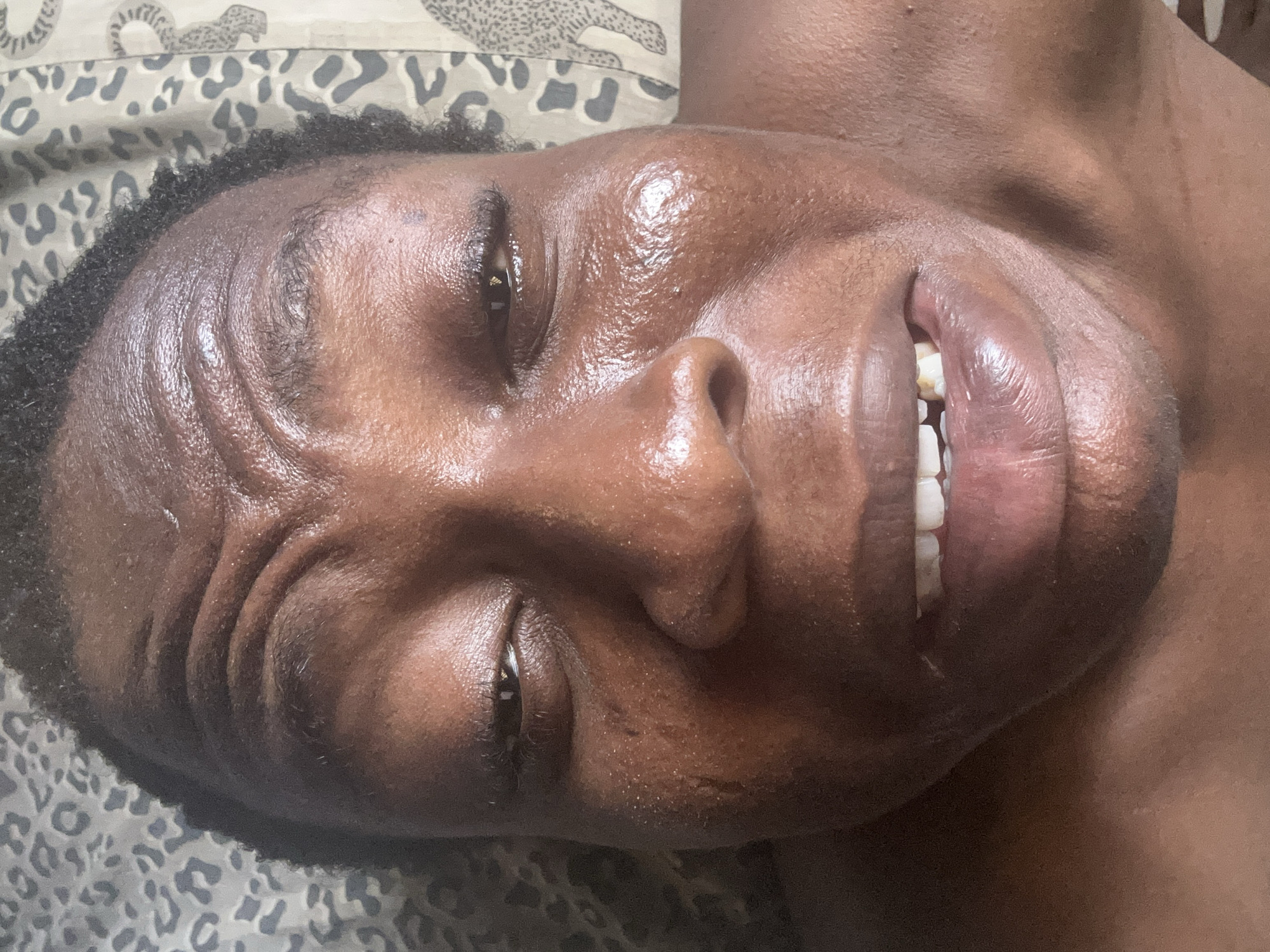 A close-up, slightly off-kilter image shows a person of color with a shiny face smiling. The person has short, dark hair. Their eyes are dark, and their skin is glistening. The person's teeth are visible. A patterned surface, possibly bedding, is partially visible in the background. The location is not discernible from the image.