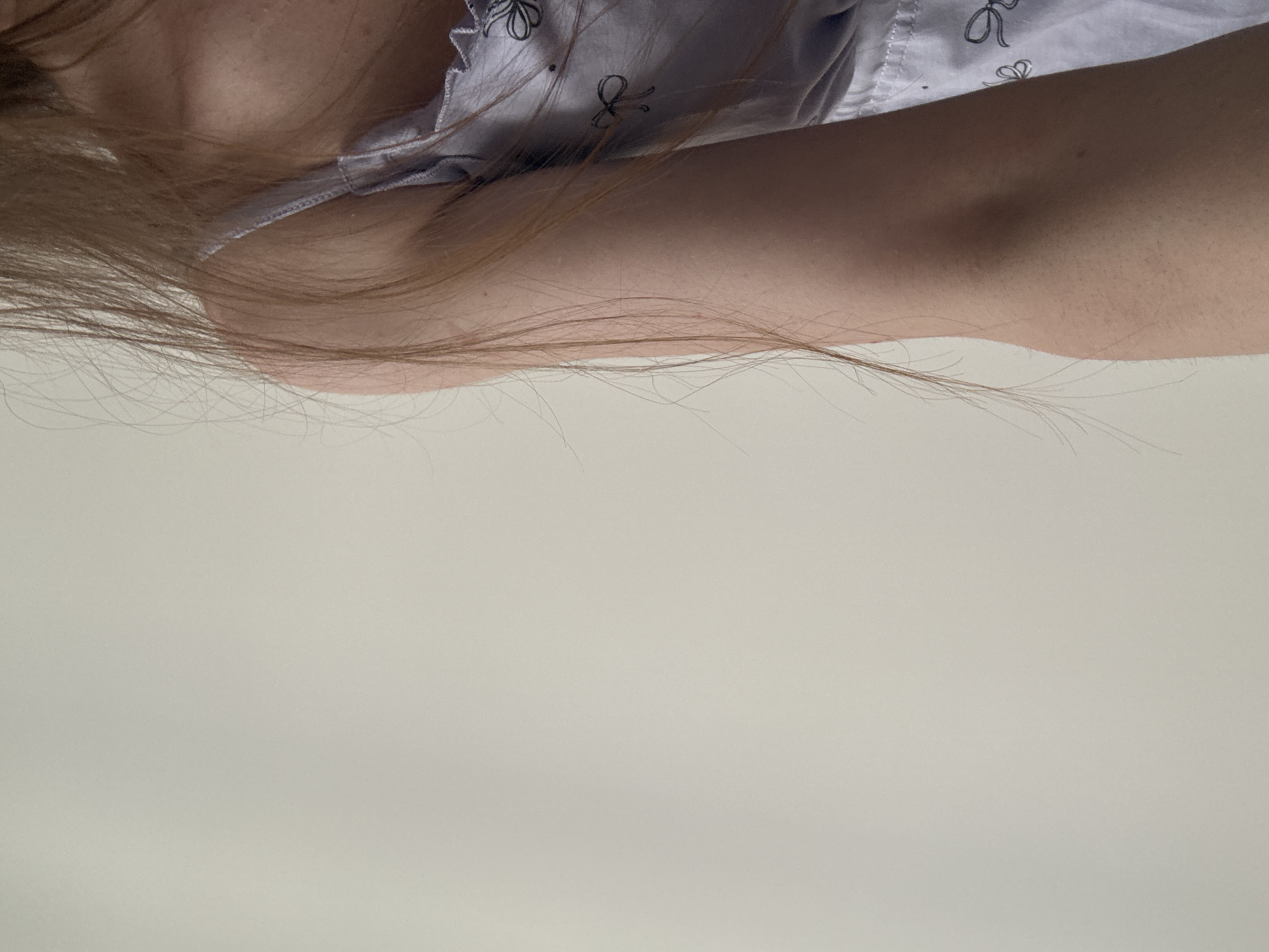 The image shows a close-up of a person's arm and shoulder. The person has light skin and light brown hair. They are wearing a light-colored garment with a floral pattern. The background is a plain, light gray surface. There is no indication of the location being Moscow, Russia or any other city.