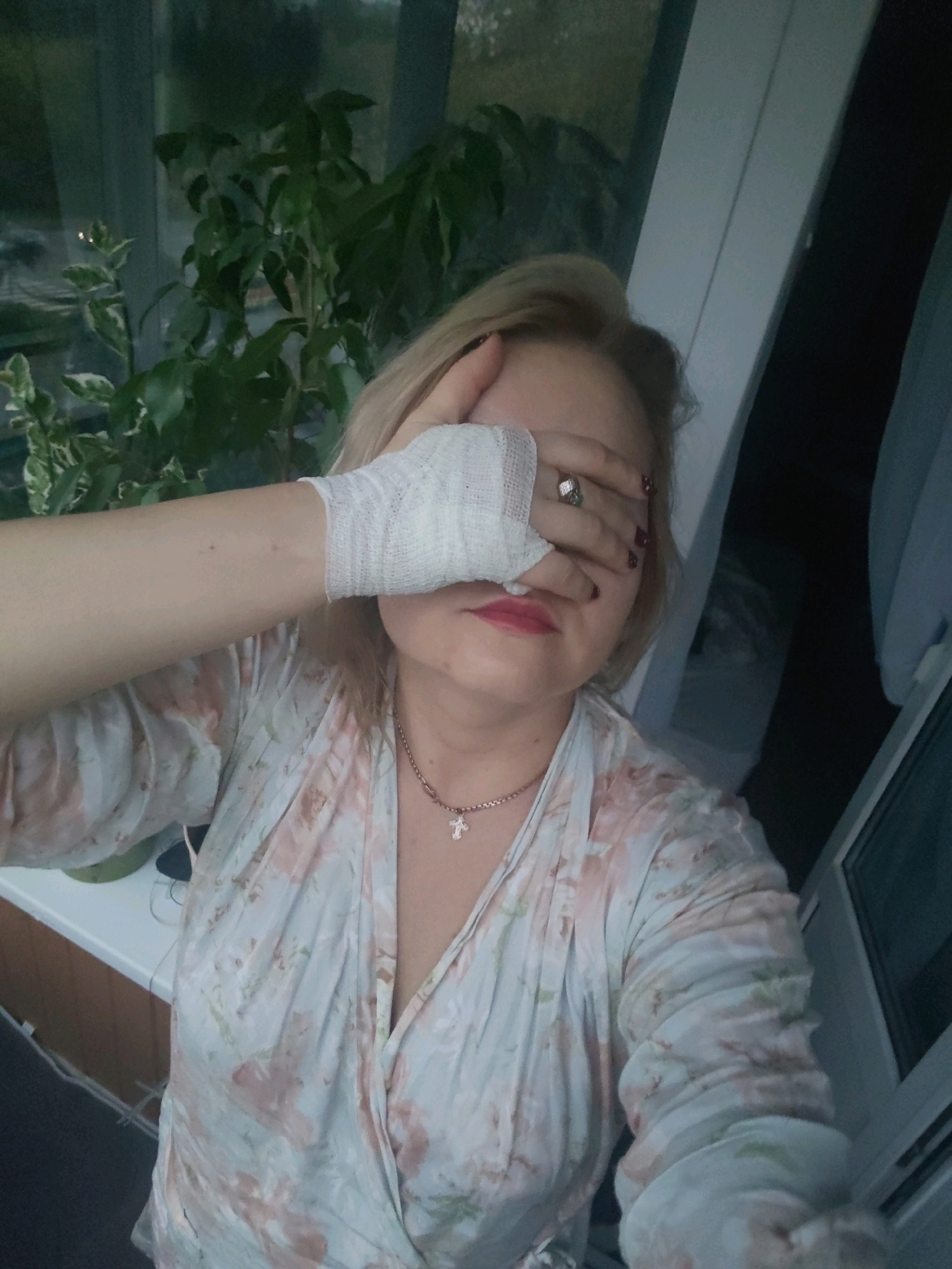 A woman with blonde hair, wearing a light-colored floral robe and a silver necklace with a cross pendant, is holding her left hand over her right eye, which is bandaged. She is wearing a ring on her left ring finger and nail polish on her fingernails. The woman appears to be indoors, with a potted plant visible in the background and a window showing an outdoor scene. The image quality is low, and it is impossible to determine the specific location in Izhevsk, Russia.