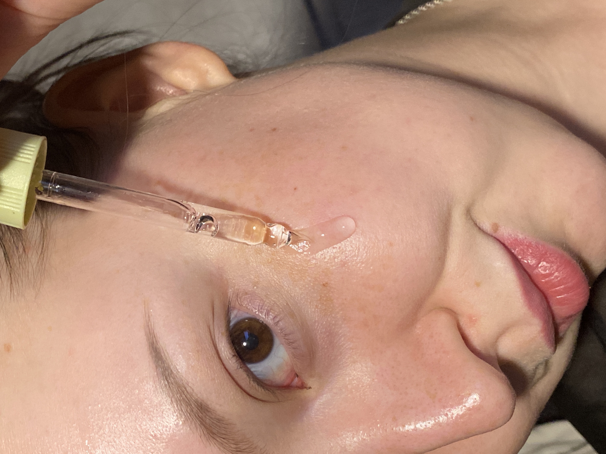 A close-up, angled view depicts a person applying a liquid product to their face using a dropper. The person is fair-skinned with brown eyes. The dropper, held in the upper left, is clear with a light green top and dispenses a clear to light-yellow liquid onto the person's forehead near their eyebrow. The focus is primarily on the person's face. The background is out of focus. The location is not evident from the image alone.