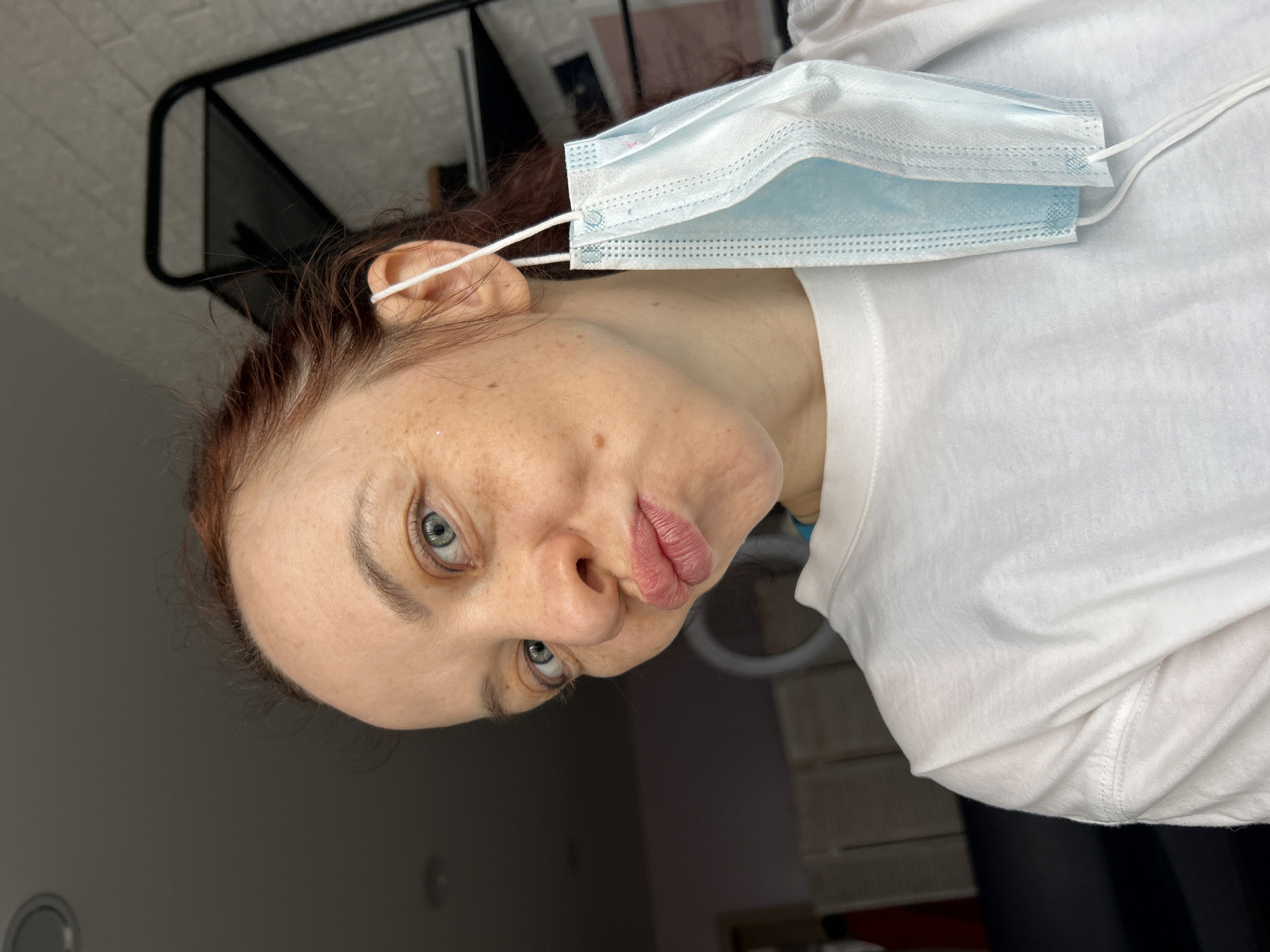 An indoor portrait features a woman with reddish-brown hair, light blue eyes, and fair skin with visible freckles. She is wearing a white short-sleeved t-shirt. The image is rotated 90 degrees clockwise, causing her head to appear tilted to the left. A light blue disposable surgical mask hangs from her right ear, resting against her jawline and chest.
The woman is looking directly at the camera, making a playful "pouting" or "kissing" face with her lips. Her expression conveys a lighthearted and perhaps humorous mood.
The background is somewhat blurred but shows elements of an indoor setting. On the upper left, there is a dark, angular metal structure, possibly part of a piece of furniture like a shelf or bed frame, against a lighter, textured wall or ceiling. On the right, the background is mostly white, consistent with a wall or another piece of furniture. No specific time of day is discernible, and the lighting appears to be artificial or diffused. There is no visible text on the mask or elsewhere in the image.