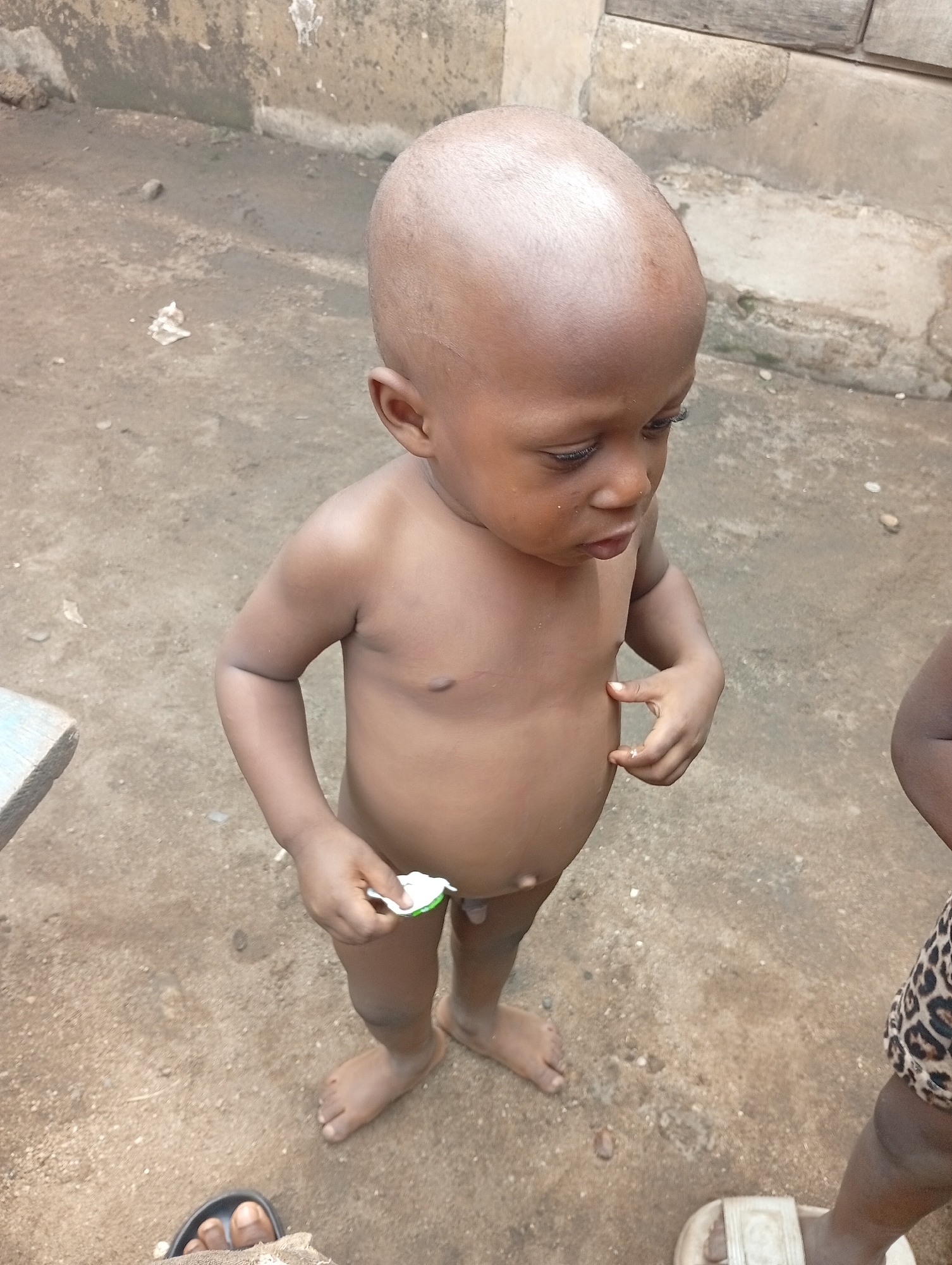 A high-angle medium shot depicts a nude, dark-skinned toddler holding a small, white object, possibly a toy, in his left hand. The toddler is standing barefoot on a concrete surface. To the right is the leg of another child wearing a leopard-print patterned garment. To the right and above the toddler is a concrete wall with some discoloration. The location is potentially in a residential area of Owerri, Nigeria.