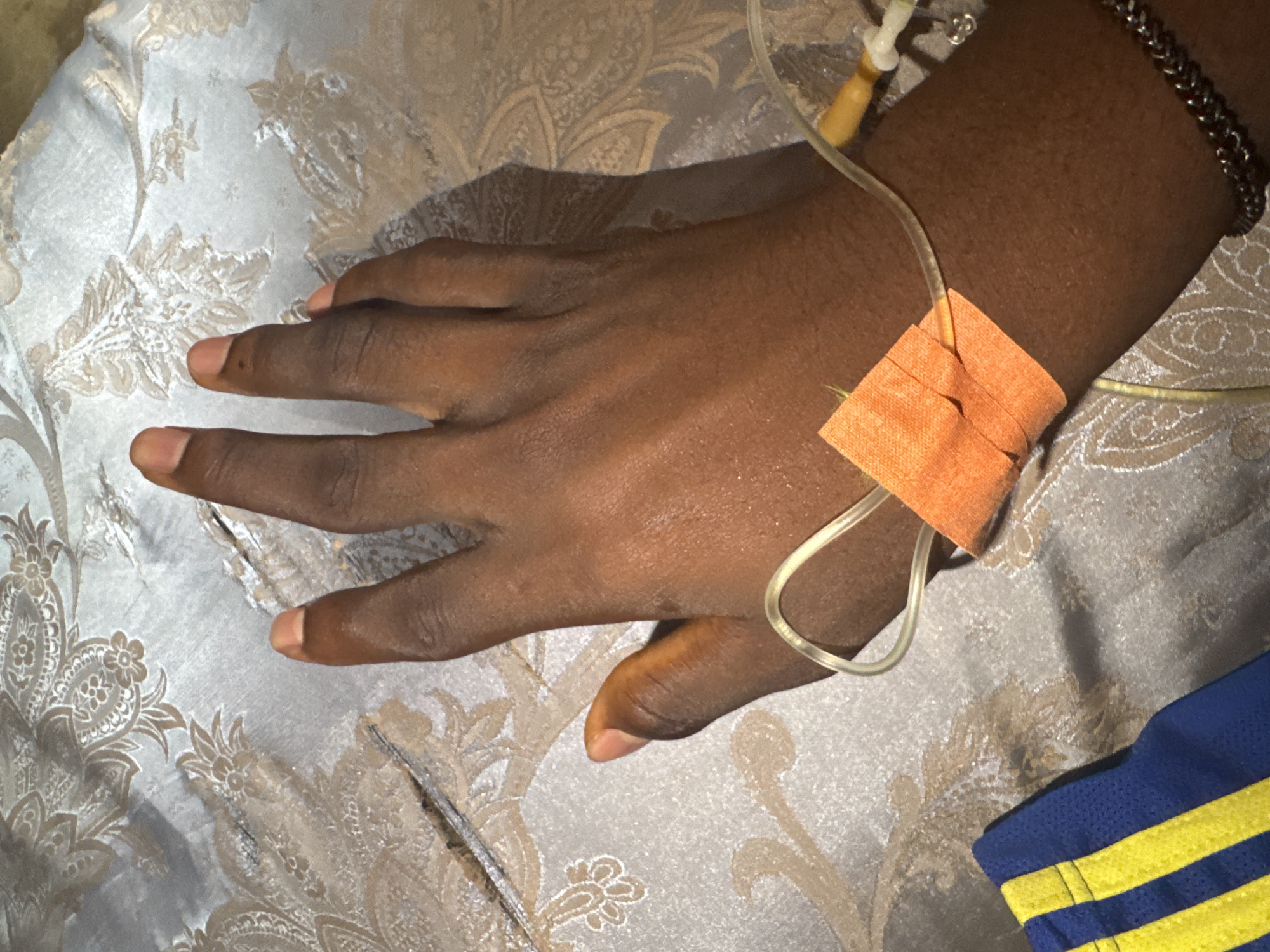 A dark-skinned person's left hand is lying on a patterned fabric, possibly a bed sheet. An IV line is inserted into the wrist and secured with an orange bandage. A dark-colored bracelet is visible on the wrist. A blue garment with yellow stripes is present in the lower right corner of the image. The location is assumed to be Oboama, Nigeria.