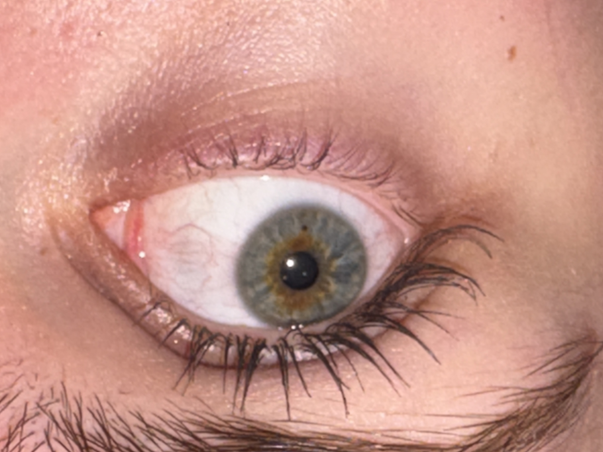 An eye close-up is shown. The eye is a hazel-grey color with a dark pupil. There are some blood vessels visible in the white of the eye. The eyelashes are dark and the eyebrow is thick and unkempt. The skin around the eye is pale with some shine, and there is a mole on the upper right of the eyelid. There is nothing in the image that indicates any location, including the city of Perm, Russia.